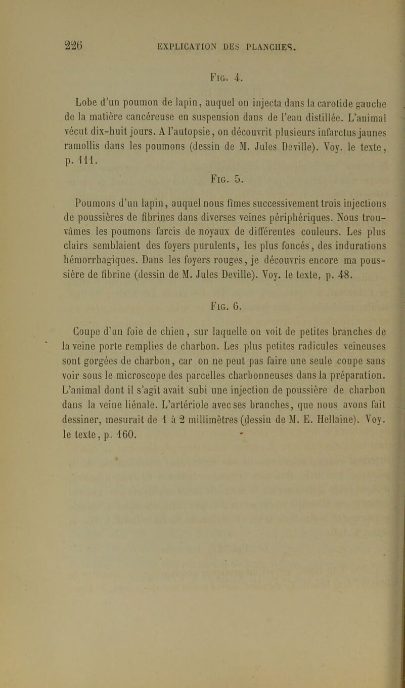 Fr&. 4. Lobe d’un poumon de lapin, auquel on injecta dans la carotide gauche de la matière cancéreuse en suspension dans de l’eau distillée. L’animal vécut dix-huit jours. A l’autopsie, on découvrit plusieurs infarctus jaunes ramollis dans les poumons (dessin de M. Jules Deville). Voy. le texte, p. 111. Fig. 5. Poumons d’un lapin, auquel nous finies successivement trois injections de poussières de fibrines dans diverses veines périphériques. Nous trou- vâmes les poumons farcis de noyaux de différentes couleurs. Les plus clairs semblaient des foyers purulents, les plus foncés, des indurations hémorrhagiques. Dans les foyers rouges, je découvris encore ma pous- sière de fibrine (dessin de M. Jules Deville). Voy. le texte, p. 48. Fig. 6. Coupe d’un foie de chien, sur laquelle on voit de petites branches de la veine porte remplies de charbon. Les plus petites radicules veineuses sont gorgées de charbon, car on ne peut pas faire une seule coupe sans voir sous le microscope des parcelles charbonneuses dans la préparation. L’animal dont il s’agit avait subi une injection de poussière de charbon dans la veine liénale. L’artériole avec ses branches, que nous avons fait dessiner, mesurait de 1 à 2 millimètres (dessin de M. E. Hellaine). Voy. le texte, p. 160.