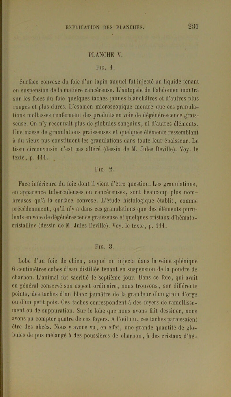 PLANCHE V. Fig. 1. Surface convexe du foie d’un lapin auquel fut injecté un liquide lenant en suspension de la matière cancéreuse. L’autopsie de l’abdomen montra sur les faces du foie quelques taches jaunes blanchâtres et d’autres plus rouges et plus dures. L’examen microscopique montre que ces granula- tions mollasses renferment des produits en voie de dégénérescence grais- seuse. On n’y reconnaît plus de globules sanguins, ni d’autres éléments. Une masse de granulations graisseuses et quelques éléments ressemblant à du vieux pus constituent les granulations dans toute leur épaisseur. Le tissu circonvoisin n’est pas altéré (dessin de M. Jules Deville). Voy. le texte, p. 411. Fig. 2. Face inférieure du foie dont il vient d’être question. Les granulations, en apparence tuberculeuses ou cancéreuses, sont beaucoup plus nom- breuses qu’à la surface convexe. L’étude histologique établit, comme précédemment, qu’il n’y a dans ces granulations que des éléments puru- lents en voie de dégénérescence graisseuse et quelques cristaux d’hémato- cristalline (dessin de M. Jules Deville). Voy. le texte, p. 111. Fig. 3. Lobe d’un foie de chien, auquel on injecta dans la veine splénique 6 centimètres cubes d’eau distillée tenant en suspension de la poudre de charbon. L’animal fut sacrifié le septième jour. Dans ce foie, qui avait en général conservé son aspect ordinaire, nous trouvons, sur différents points, des taches d’un blanc jaunâtre de la grandeur d’un grain d’orge ou d’un petit pois. Ces taches correspondent à des foyers de ramollisse- ment ou de suppuration. Sur le lobe que nous avons fait dessiner, nous avons pu compter quatre de ces foyers. A l’œil nu, ces taches paraissaient être des abcès. Nous y avons vu, en effet, une grande quantité de glo- bules de pus mélangé à des poussières de charbon, à des cristaux d’hé-