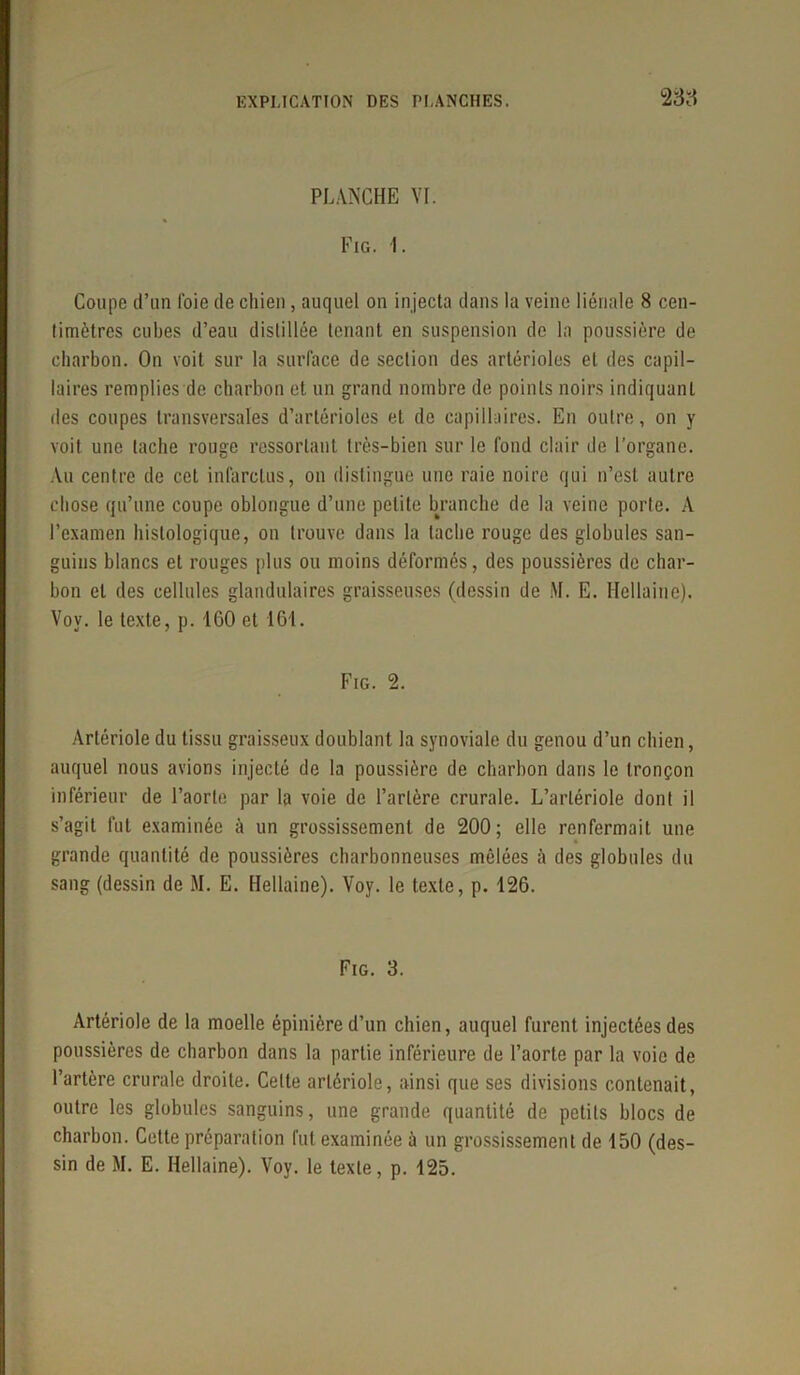 PLANCHE VI. Fig. 1. Coupe d’un l'oie de chien, auquel on injecta dans la veine liénale 8 cen- timètres cubes d’eau distillée tenant en suspension de la poussière de charbon. On voit sur la surface de section des artérioles et des capil- laires remplies de charbon et un grand nombre de points noirs indiquant des coupes transversales d’artérioles et de capillaires. En outre, on y voit une tache rouge ressortant très-bien sur le fond clair de l’organe. Au centre de cet infarctus, on distingue une raie noire qui n’est autre chose qu’une coupe oblongue d’une petite branche de la veine porte. À l’examen histologique, on trouve dans la tache rouge des globules san- guins blancs et rouges plus ou moins déformés, des poussières de char- bon et des cellules glandulaires graisseuses (dessin de M. E. HeÜaifle). Vov. le texte, p. 1 GO et 161. Fig. 2. Artériole du tissu graisseux doublant la synoviale du genou d’un chien, auquel nous avions injecté de la poussière de charbon dans le tronçon inférieur de l’aorte par la voie de l’artère crurale. L’artériole dont il s’agit fut examinée à un grossissement de 200; elle renfermait une grande quantité de poussières charbonneuses mêlées à des globules du sang (dessin de M. E. Hellaine). Voy. le texte, p. 126. Fig. 3. Artériole de la moelle épinière d’un chien, auquel furent injectées des poussières de charbon dans la partie inférieure de l’aorte par la voie de l’artère crurale droite. Celte artériole, ainsi que ses divisions contenait, outre les globules sanguins, une grande quantité de petits blocs de charbon. Cette préparation fut examinée à un grossissement de 150 (des-