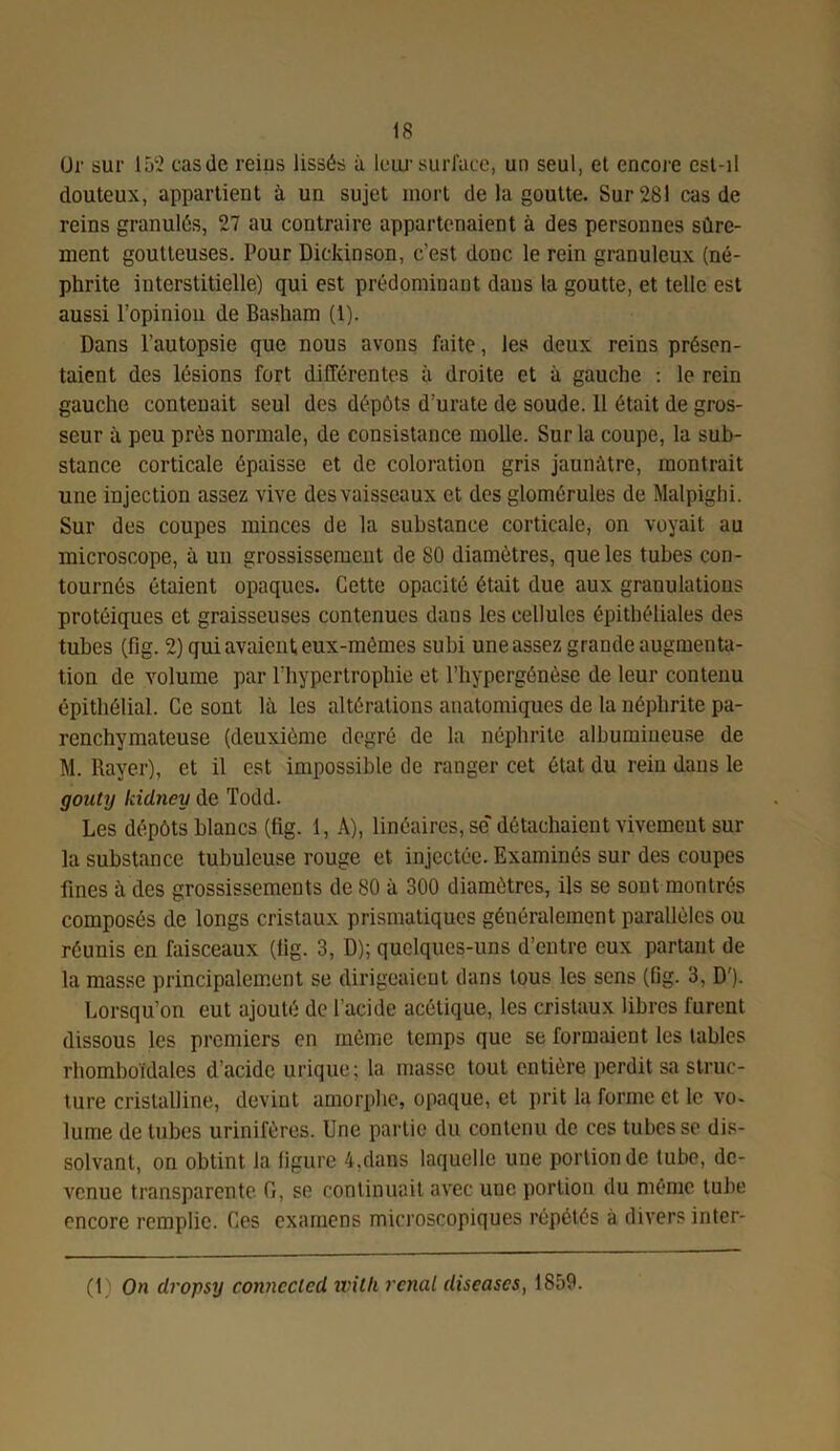 Or sur 152 easde reius lissés à leux surface, un seul, et encore est-il douteux, appartient à un sujet mort de la goutte. Sur 281 cas de reins granulés, 27 au contraire appartenaient à des personnes sûre- ment goutteuses. Pour Dickinson, c'est donc le rein granuleux (né- phrite interstitielle) qui est prédominant dans la goutte, et telle est aussi l’opinion de Basham (1). Dans l’autopsie que nous avons faite, les deux reins présen- taient des lésions fort différentes à droite et à gauche : le rein gauche contenait seul des dépôts d’urate de soude. 11 était de gros- seur à peu prés normale, de consistance molle. Sur la coupe, la sub- stance corticale épaisse et de coloration gris jaunâtre, montrait une injection assez vive des vaisseaux et des glomérules de Malpighi. Sur des coupes minces de la substance corticale, on voyait au microscope, à un grossissement de 80 diamètres, que les tubes con- tournés étaient opaques. Cette opacité était due aux granulations protéiques et graisseuses contenues dans les cellules épithéliales des tubes (fig. 2) qui avaient eux-mêmes subi une assez grande augmenta- tion de volume par l’hypertrophie et l’hypergénèse de leur contenu épithélial. Ce sont là les altérations anatomiques de la néphrite pa- renchymateuse (deuxième degré de la néphrite albumineuse de M. Rayer), et il est impossible de ranger cet état du rein dans le gonty kid7iey de Todd. Les dépôts blancs (fig. 1, A), linéaires, se' détachaient vivement sur la substance tubuleuse rouge et injectée. Examinés sur des coupes fines à des grossissements de 80 à 300 diamètres, ils se sont montrés composés de longs cristaux prismatiques généralement parallèles ou réunis en faisceaux (fig. 3, D); quelques-uns d’entre eux partant de la masse principalement se dirigeaient dans tous les sens (fig. 3, D'). Lorsqu’on eut ajouté de l’acide acétique, les cristaux libres furent dissous les premiers en môme temps que se formaient les tables rhomboïdales d’acide urique; la masse tout entière perdit sa struc- ture cristalline, devint amorphe, opaque, et prit la forme et le vo- lume de tubes urinifères. Une partie du contenu de ces tubes se dis- solvant, on obtint la figure 4,dans laquelle une portion de tube, de- venue transparente. G, se continuait avec une portion du mémo tube encore remplie. Ces examens microscopiques répétés à divers inter- (1 On dropsy conncclcd with rcnal diseascs, 1859.