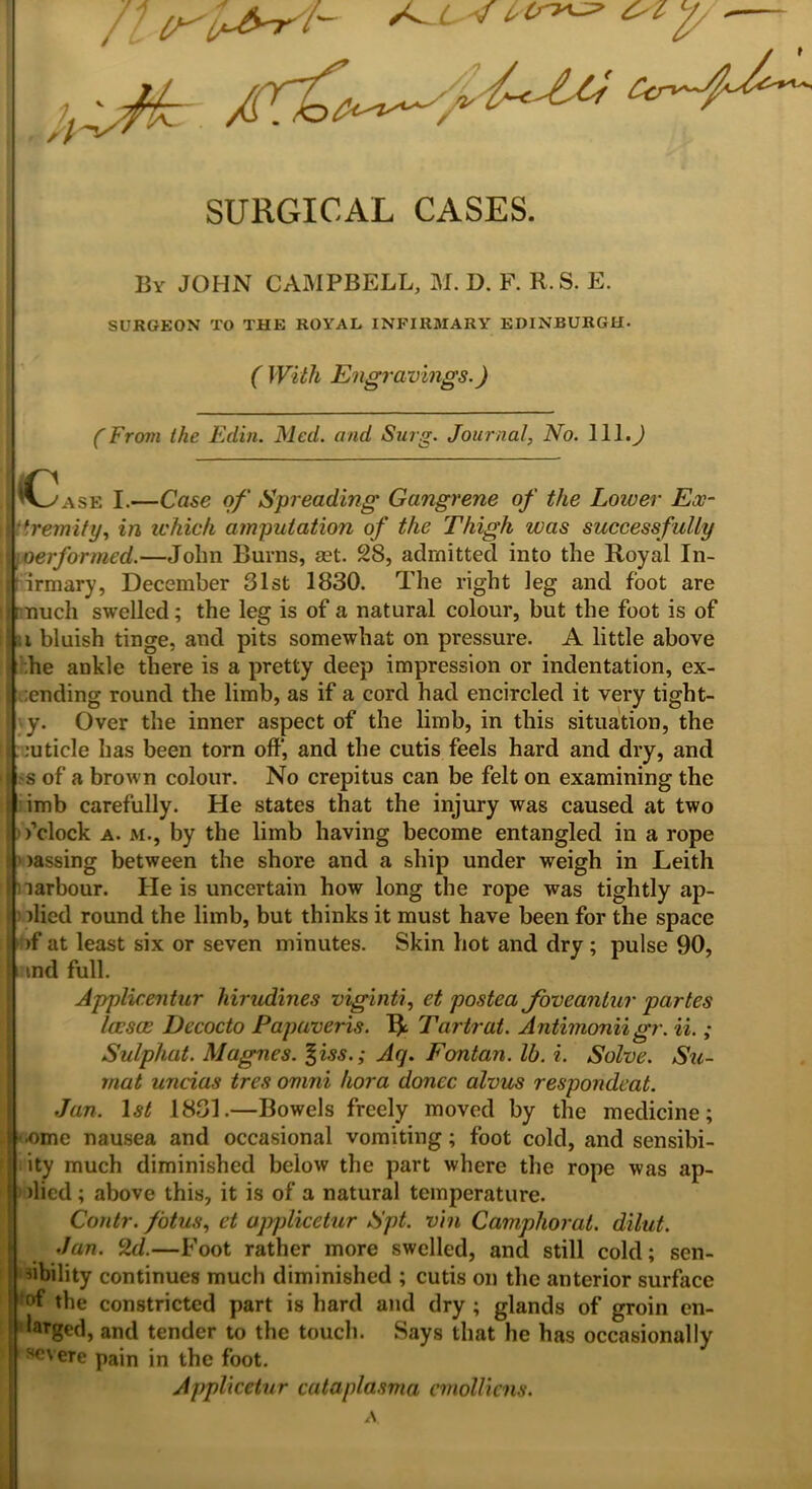 ■' ^ u^rh * * Cry^ C' l h SURGICAL CASES. Br JOHN CAMPBELL, M. D. F. R.S. E. SURGEON TO THE ROYAL INFIRMARY EDINBURGH- ( With Engravings.) (From the Edin. Med. and Surg. Journal, No. III.) ^Case I.—Case of Spreading Gangrene of the Lower Ex- tremity, in which amputation of the Thigh was successfully performed.—John Burns, set. 28, admitted into the Royal In- firmary, December 31st 1830. The right leg and foot are ■ nuch swelled; the leg is of a natural colour, but the foot is of i bluish tinge, and pits somewhat on pressure. A little above he ankle there is a pretty deep impression or indentation, ex- ending round the limb, as if a cord had encircled it very tight- y. Over the inner aspect of the limb, in this situation, the si :uticle has been torn off, and the cutis feels hard and dry, and I s of a brown colour. No crepitus can be felt on examining the i imb carefully. He states that the injury was caused at two i fclock a. m., by the limb having become entangled in a rope 5 >assing between the shore and a ship under weigh in Leith larbour. He is uncertain how long the rope was tightly ap- I died round the limb, but thinks it must have been for the space )f at least six or seven minutes. Skin hot and dry ; pulse 90, i md full. Applicentur hirudines viginti, et postea Joveantur partes loesae Decocto Papaveris. R Tartrat. Antimonii gr. ii.; Sulphat. Magues. %iss.; Ay. Fontan. lb. i. Solve. Su- ra at uncias tres omni hora donee alvus respondeat. Jan. 1 st 1831.—Bowels freely moved by the medicine; ■ome nausea and occasional vomiting; foot cold, and sensibi- ity much diminished below the part where the rope was ap- plied ; above this, it is of a natural temperature. Contr. fotus, ct upplicetur Spt. vin Camphorat. dilut. Jan. 2d.—Foot rather more swelled, and still cold; sen- ability continues much diminished ; cutis on the anterior surface °f the constricted part is hard and dry ; glands of groin en- larged, and tender to the touch. Says that he has occasionally SCVere pain in the foot. Applxcetur cutaplasma emolliens.