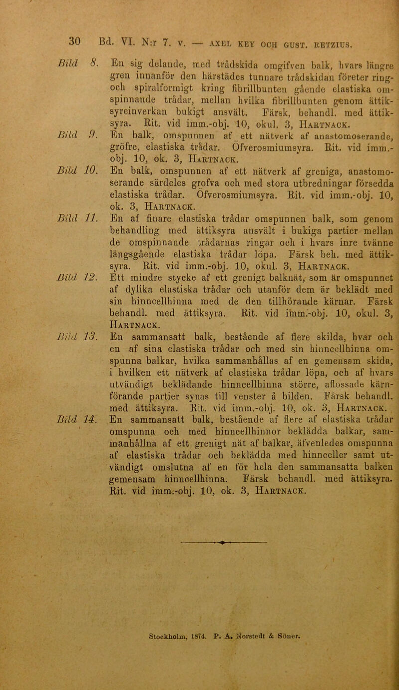 Bild 8. Bild 9. Bild 10. Bild 11. Bild 12. Bild 13. Bild 14. \ hu sig delande, med trådskida omgifven balk, livars längre gren innanför den härstädes tunnare trådskidan företer ring- och spiralformigt kring fibrillbunten gående elastiska om- spinnande trådar, mellan hvilka fibrillbunten genom ättik- syreinverkan bukigt ansvält. Färsk, behandl. med ättik- syra. Bit. vid imm.-obj. 10, okul. 3, Hartnack. En balk, omspunnen af ett nätverk af anastomoserande, gröfre, elastiska trådar. Öfverosmiumsyra. Bit. vid imm.- obj. 10, ok. 3, Hartnack. En balk, omspunnen af ett nätverk af greniga, anastomo- serande särdeles grofva och med stora utbredningar försedda elastiska trådar. Öfverosmiumsyra. Bit. vid imm.-obj. 10, ok. 3, Hartnack. En af finare elastiska trådar omspunnen balk, som genom behandling med ättiksyra ansvält i bukiga partier mellan de omspinnande trådarnas ringar och i hvars inre tvänne längsgående elastiska trådar löpa. Färsk beh. med ättik- syra. Bit. vid imm.-obj. 10, okul. 3, Hartnack. Ett mindre stycke af ett grenigt balknät, som är omspunnet af dylika elastiska trådar och utanför dem är beklädt med sin hinncellhinna med de den tillhörande kärnar. Färsk behandl. med ättiksyra. Bit. vid imm.-obj. 10, okul. 3, Hartnack. En sammansatt balk, bestående af flere skilda, hvar och en af sina elastiska trådar och med sin hinncellhinna om- spunna balkar, hvilka sammanhållas af en gemensam skida, i hvilken ett nätverk af elastiska trådar löpa, och af hvars utvändigt beklädande hinncellhinna större, aflossade kärn- förande partier synas till venster å bilden. Färsk behandl. med ättiksyra. Bit. vid imm.-obj. 10, ok. 3, Hartnack. En sammansatt balk, bestående af flere af elastiska trådar omspunna och med hinncellhinnor beklädda balkar, sam- manhållna af ett grenigt nät af balkar, äfvenledes omspunna af elastiska trådar och beklädda med hinnceller samt ut- vändigt omslutna af en för hela den sammansatta balken gemensam hinncellhinna. Färsk behandl. med ättiksyra. Bit. vid imm.-obj. 10, ok. 3, Hartnack. ♦