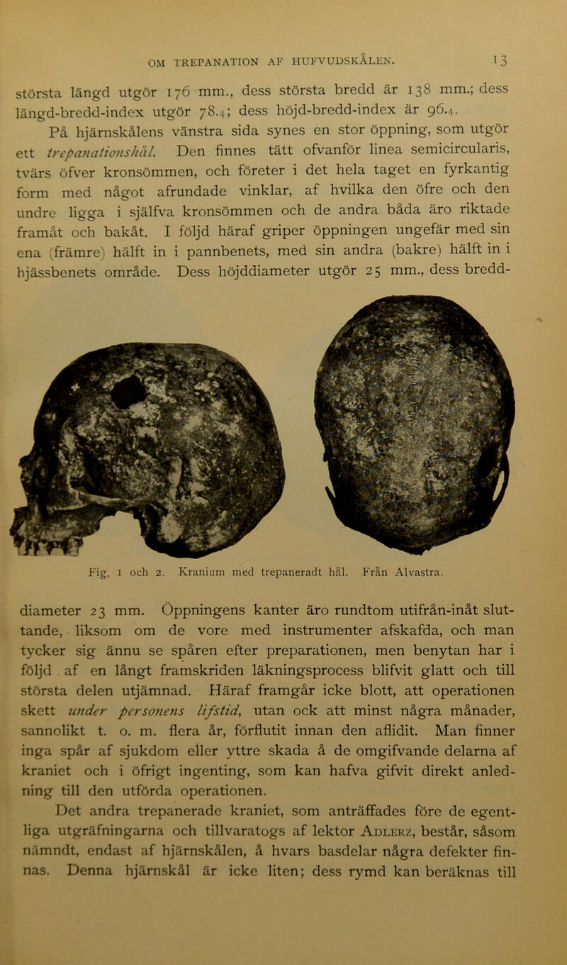 största längd utgör 176 mm., dess största bredd är 138 mm.; dess längd-breckl-index utgör 78.4; dess höjd-bredd-index är 96.4. På hjärnskålens vänstra sida synes en stor öppning, som utgör ett trepanationshå 1. Den finnes tätt ofvanför linea semicircularis, tvärs öfver kronsömmen, och företer i det hela taget en fyrkantig form med något afrundade vinklar, af hvilka den öfre och den undre ligga i själfva kronsömmen och de andra bada äro riktade framåt och bakåt. I följd häraf griper öppningen ungefär med sin ena (främre) hälft in i pannbenets, med sin andra (bakre) hälft in i hjässbenets område. Dess höjddiameter utgör 25 mm., dess bredd- Fig. 1 och 2. Kranium med trepaneradt hål. Från Alvastra. diameter 23 mm. Öppningens kanter äro rundtorn utifrån-inåt slut- tande, liksom om de vore med instrumenter afskafda, och man tycker sig ännu se spåren efter preparationen, men benytan har i följd . af en långt framskriden läkningsprocess blifvit glatt och till största delen utjämnad. Häraf framgår icke blott, att operationen skett under personens lifstid, utan ock att minst några månader, sannolikt t. o. m. flera år, förflutit innan den aflidit. Man finner inga spår af sjukdom eller yttre skada å de omgifvande delarna af kraniet och i öfrigt ingenting, som kan hafva gifvit direkt anled- ning till den utförda operationen. Det andra trepanerade kraniet, som anträffades före de egent- liga utgräfningarna och tillvaratogs af lektor Adlerz, består, såsom nämndt, endast af hjärnskålen, å hvars basdelar några defekter fin- nas. Denna hjärnskål är icke liten; dess rymd kan beräknas till