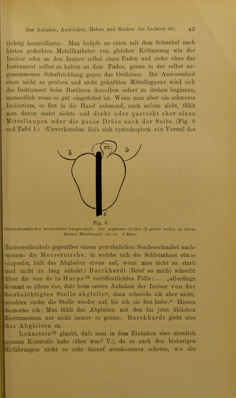 richtig kontrollierte. Man knüpfe an einen mit dem Schnabel nach hinten gedrehten Metallkatheter von gleicher Krümmung wie der Incisor oder an den Incisor selbst einen Faden und ziehe ohne das Instrument selbst zu halten an dem Faden, genau in der selbst an- genommenen Schaftrichtung gegen das Orificium. Bei Anwesenheit eines nicht zu grofsen und nicht gekerbten Mittellappens wird sich das Instrument beim Berühren desselben sofort zu drehen beginnen, namentlich wenn es gut eingefettet ist. Wenn man aber ein schweres Incisorium, es fest in die Hand nehmend, nach aufsen zieht, fühlt man davon meist nichts und dreht oder quetscht eher einen Mittellappen oder die ganze Drüse nach der Seite. (Fig. 8 und Tafel I.) (Unverkennbar liefs sich cystoskopisch ein Vorteil dos Halbschematischer horizontaler Längsschnitt. Der angehakte Incisor (i) gleitet rechts an einem kleinen Mittellappen (wi) ab. h Blase. iincisorschnabels gegenüber einem gewöhnlichen Sondenschnabel nach- 'weisen: die Messernische, in welche sich die Schleimhaut etwas cinprefstj hält das Abgleiten etwas auf, wenn man nicht zu stark uud nicht zu lang anhakt.) Burckhardt (Brief an mich) schreibt über die von de la Harpe veröffentlichten Fälle: . . . „allerdings Aommt es öfters vor, dafs beim ersten Anhaken der Incisor von der ibeabsichtigten Stelle abgleitet; dann schneide ich aber nicht, •sondern suche die Stelle wieder auf, bis ich sie fest habe.“ Hierzu ibemerke ich: Mau fühlt das Abgleiten mit den bis jetzt üblichen iiInstrumenten nur nicht immer so genau. Burckhardt giebt also das Abgleiten zu. Lohnsteinglaubt, dafs man in dem Einhakeu eine ziemlich benaue Kontrolle habe (über was? V.), da es nach den bisherigen ^Erfahrungen nicht so sehr darauf anzukommen scheine, wo die