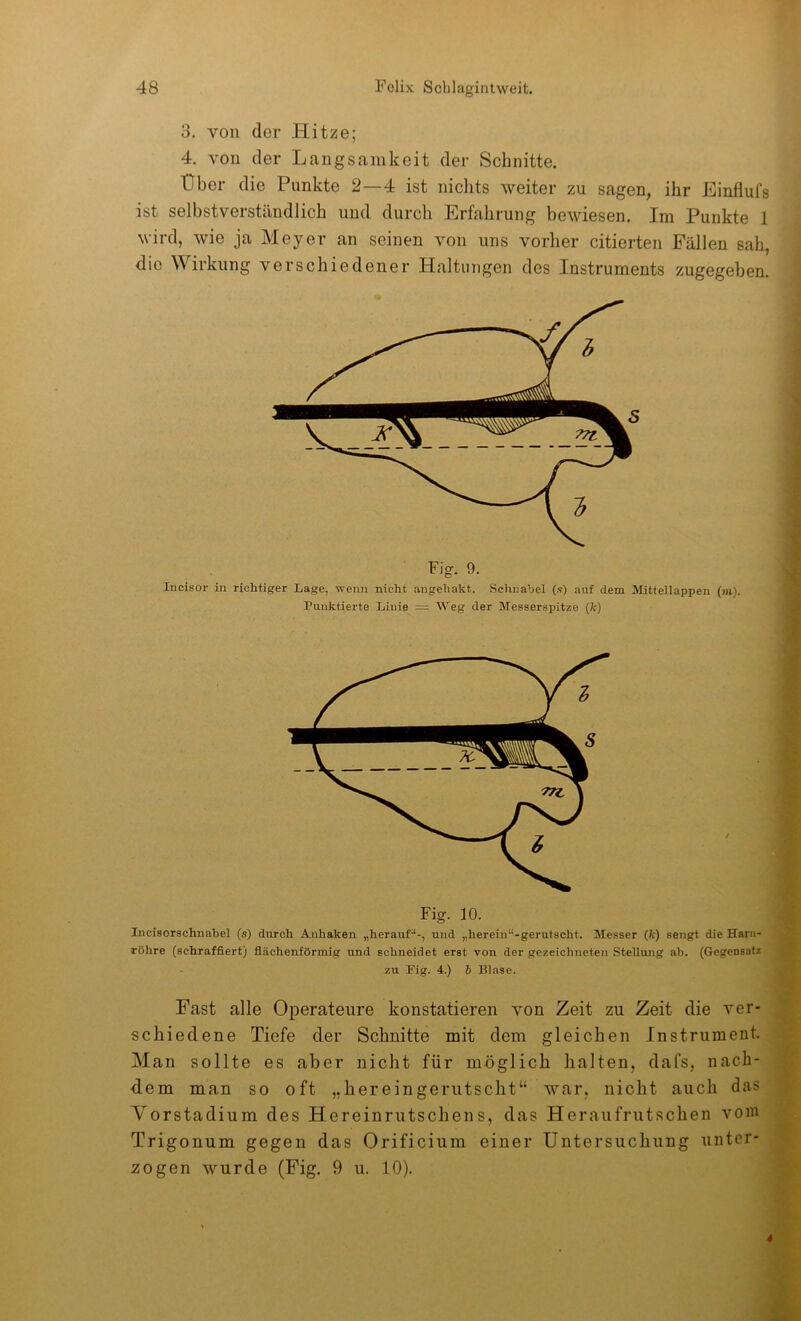 3. von der Hitze; 4. von der Langsamkeit der Schnitte. Über die Punkte 2—4 ist nichts weiter zu sagen, ihr Einflufs ist selbstverständlich und durch Erfahrung bewiesen. Im Punkte 1 wird, wie ja Meyer an seinen von uns vorher citierten Fällen sah, die Wirkung verschiedener Haltungen des Instruments zugegeben. Fig. 9. Incisor in richtiger Lage, wenn nicht angeliakt. Schnabel (s) auf dem Mittellappen (ju). Punktierte Linie = Weg der Messerspitze (fc) Incisorschnahel (s) durch Anhaken „herauf“-, und „herein“-gerutscht. Messer (k) sengt die Harn- röhre (schraffiert) flächenförmig und schneidet erst von der gezeichneten Stellung ab. (Gegensatz zu Mg. 4.) b Blase. Fast alle Operateure konstatieren von Zeit zu Zeit die ver- schiedene Tiefe der Schnitte mit dem gleichen Instrument. Man sollte es aber nicht für möglich halten, dafs, nach- dem man so oft „hereingerutscht“ war, nicht auch das Vorstadium des Hereinrutschens, das Heraufrutschen vom Trigonum gegen das Orificium einer Untersuchung unter- zogen wurde (Fig. 9 u. 10).