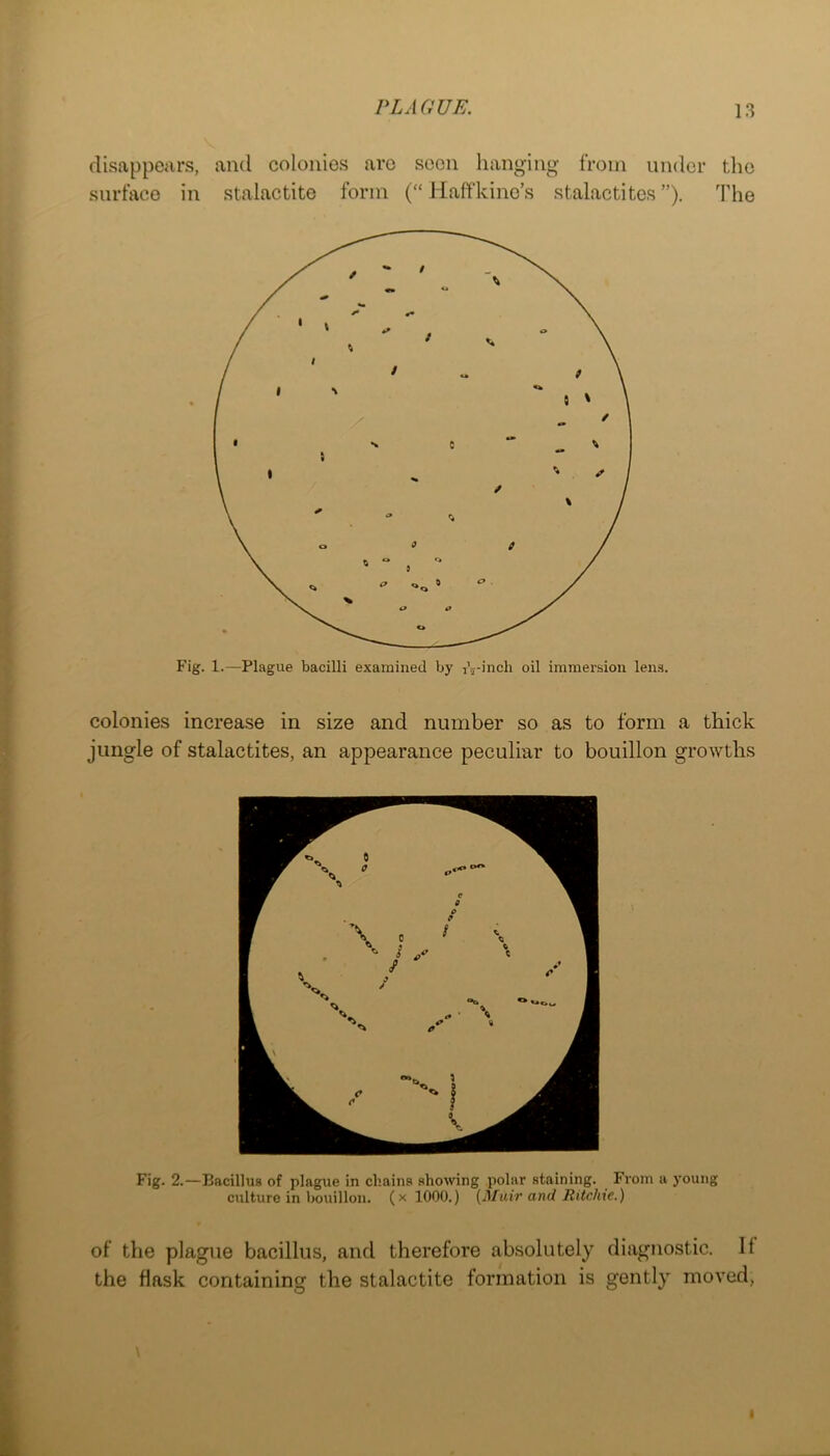 disappears, and colonies arc scon hanging from under the surface in stalactite form (“ Haffkinc’s stalactites”). The Fig. 1.—Plague bacilli examined by I’j-inch oil immersion lens. colonies increase in size and number so as to form a thick jungle of stalactites, an appearance peculiar to bouillon growths Fig. 2.—Bacillus of plague in chains showing polar staining. From a young culture in bouillon, (x 1000.) {Muir and Ritchie.) of the plague bacillus, and therefore absolutely diagnostic. 11 the flask containing the stalactite formation is gently moved, i