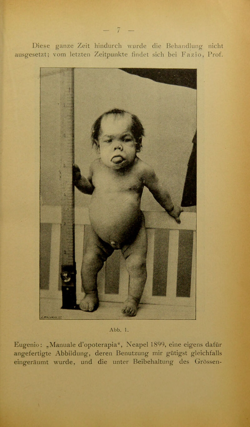 Diese ganze Zeit hindurch wurde die Behandlung nicht ausgesetzt; vom letzten Zeitpunkte findet sich bei Fazio, Prof. Abb. 1. Eugenio: „Manuale d'opoterapia“, Neapel 1899, eine eigens dafür angefertigte Abbildung, deren Benutzung mir gütigst gleichfalls eingeräumt wurde, und die unter Beibehaltung des Grössen-