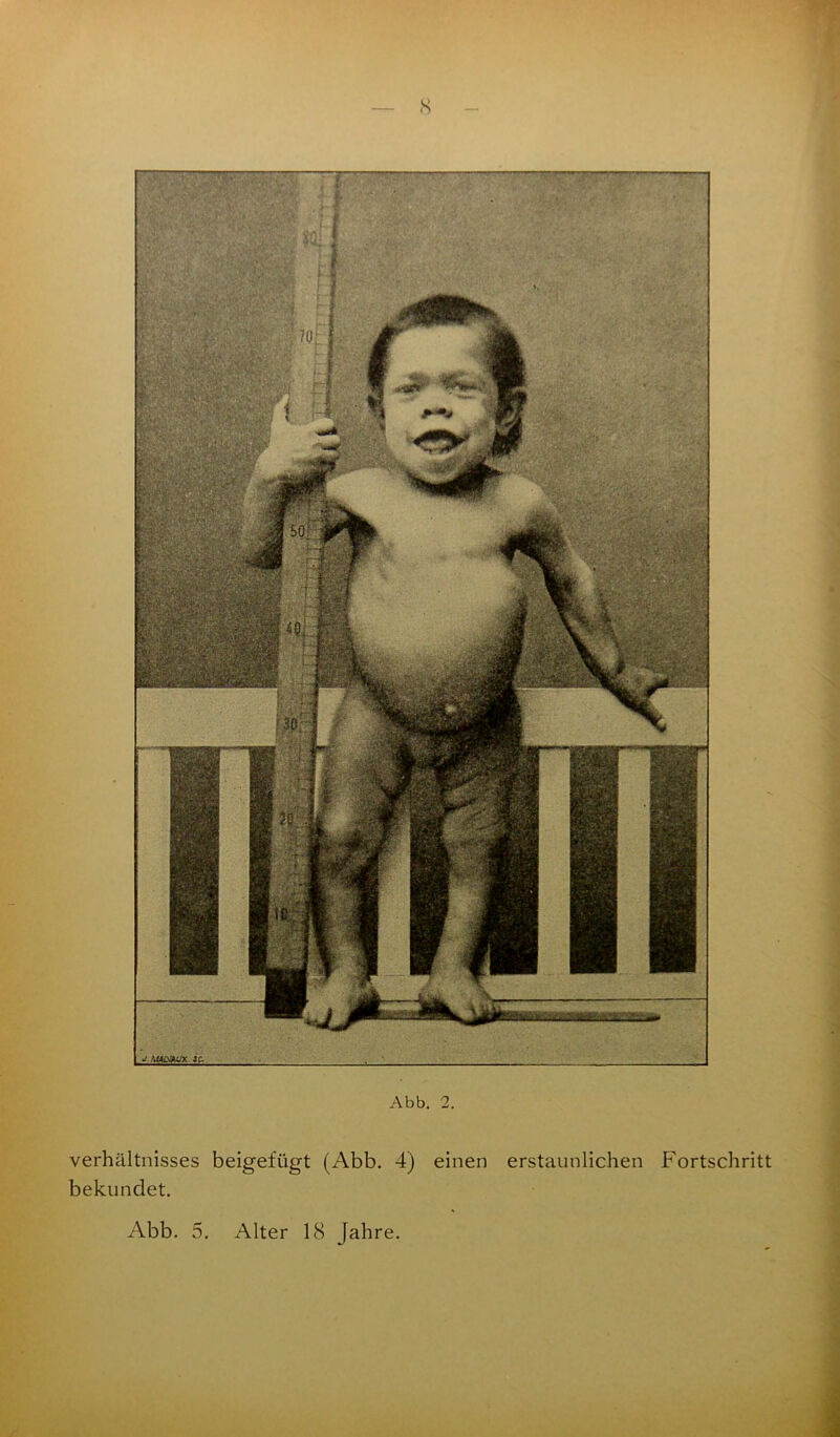 s Abb. 2. Verhältnisses beigefügt (Abb. 4) einen erstaunlichen Fortschritt bekundet.