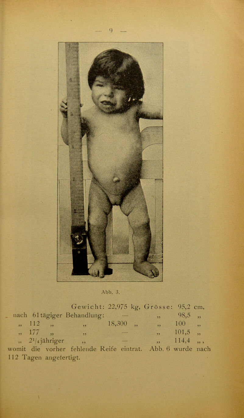 Abb. 3. Gewicht: 22,975 kg, Grösse: 95,2 cm. _ nach 61 tägiger Behandlung: 5 5 18,300 55 „ 112 „ 177 „ 2^4 jähriger „ womit die vorher fehlende Reife eintrat. 112 Tagen angefertigt. 98,5 100 55 101,5 ” 114,4 „ , Abb. 6 wurde nach