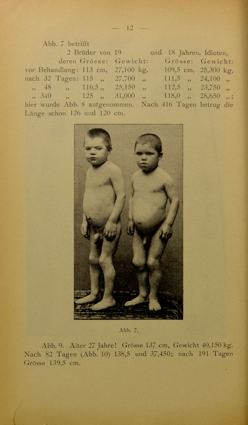 Abb. 7 betrifft 2 Brüder von 19 deren Grösse: Gewicht: vor Behandlung: 113 cm, 27,100 kg, nach 32 Tagen: 115 „ 27,700 55 48 ,, ~iO ,, 340 25,150 55 und 18 Jahren, Idioten, Grösse: Gewicht: 109.5 cm, 25,300 kg, 111.5 „ 24,100 „ 112.5 „ 23,750 „ 118,0 „ 28,650 „ 116,5 „ „ 125 „ 31,000 hier wurde Abb. 8 aufgenommen. Nach 416 Tagen betrug die Länge schon 126 und 120 cm. Abb. 7. Abb. 9. Alter 27 Jahre! Grösse 137 cm, Gewicht 40,150 kg. Nach 82 Tagen (Abb. 10) 138,5 und 37,450; nach 191 Tagen Grösse 139,5 cm.