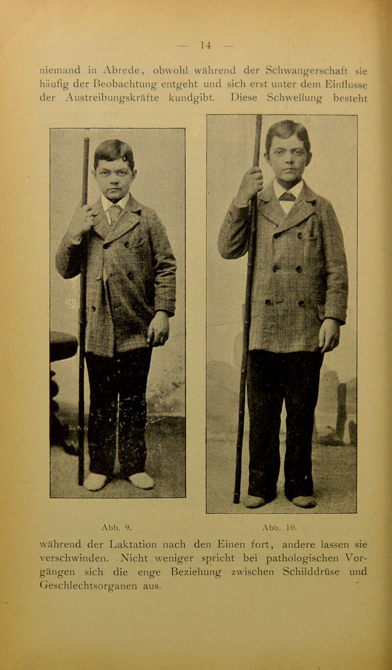 niemand in Abrede, obwohl während der Schwangerschaft sie häufig der Beobachtung entgeht und sich erst unter dem Einflüsse der Austreibungskräfte kundgibt. Diese Schwellung besteht Abb. 9. Abb. 10. während der Laktation nach den Einen fort, andere lassen sie verschwinden. Nicht weniger spricht bei pathologischen Vor- gängen sich die enge Beziehung zwischen Schilddrüse und Geschlechtsorganen aus.