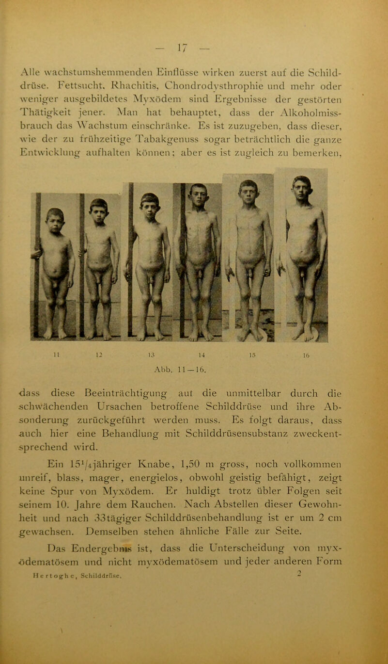 Alle wachstumshemmenden Einflüsse wirken zuerst auf die Schild- drüse. Fettsucht, Rhachitis, Chondrodysthrophie und mehr oder weniger ausgebildetes Myxödem sind Ergebnisse der gestörten Thätigkeit jener. Man hat behauptet, dass der Alkoholmiss- brauch das Wachstum einschränke. Es ist zuzugeben, dass dieser, wie der zu frühzeitige Tabakgenuss sogar beträchtlich die ganze Entwicklung aufhalten können: aber es ist zugleich zu bemerken. o o 11 12 13 14 15 16 Abb. 11-16. dass diese Beeinträchtigung aut die unmittelbar durch die schwächenden Ursachen betroffene Schilddrüse und ihre Ab- sonderung zurückgeführt werden muss. Es folgt daraus, dass auch hier eine Behandlung- mit Schilddrüsensubstanz zweckent- sprechend wird. Ein 15^4jähriger Knabe, 1,50 m gross, noch vollkommen unreif, blass, mager, energielos, obwohl geistig befähigt, zeigt keine Spur von Myxödem. Er huldigt trotz übler Folgen seit seinem 10. Jahre dem Rauchen. Nach Abstellen dieser Gewohn- heit und nach 33tägiger Schilddrüsenbehandlung ist er um 2 cm gewachsen. Demselben stehen ähnliche Fälle zur Seite. Das Endergebnis ist, dass die Unterscheidung von myx- «ödematösem und nicht myxödematösem und jeder anderen Form Hcrtoghc, Sehilddrfise. “