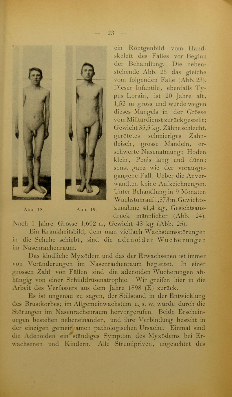 ein Röntgenbild vom I land- skelett des Falles vor Beginn o der Behandlung. I)ie neben- stehende Abb. 26 das gleiche vom folgenden Falle (Abb. 23). Dieser Infantile, ebenfalls Ty- pus Lorain, ist 20 Jahre alt, 1,52 m gross und wurde wegen dieses Mangels in der Grösse vom Militärdienst zurückgestellt; Gewicht 35,5 kg. Zähne schlecht, gerötetes schmieriges Zahn- fleisch, grosse Mandeln, er- schwerte Nasenatmung: Hoden klein, Penis lang und dünn; sonst ganz wie der vorausge- gangene Fall. Ueber die Anver- wandten keine Aufzeichnungen. Unter Behandlung in 9 Monaten Wachstum auf 1,5/3 m, Gewichts- zunahme 41,4 kg, Gesichtsaus- druck männlicher (Abb. 24). Nach 1 Jahre Grösse 1,602 m, Gewicht 43 kg (Abb. 25). Ein Krankheitsbild, dem man vielfach Wachstumsstörungen in die Schuhe schiebt, sind die adenoiden Wucherungen im Nasenrachenraum. Das kindliche Myxödem und das der Erwachsenen ist immer von Veränderungen im Nasenrachenraum begleitet. In einer grossen Zahl von Fällen sind die adenoiden Wucherungen ab- hängig von einer Schilddrüsenatrophie. Wir greifen hier in die Arbeit des Verfassers aus dem Jahre 1898 (E) zurück. Es ist ungenau zu sagen, der Stillstand in der Entwicklung des Brustkorbes,' im Allgemeinwachstum u.. s. w. würde durch die Störungen im Nasenrachenraum hervorgerufen. Beide Erschein- ungen bestehen nebeneinander, und ihre Verbindung besteht in der einzigen gemein -amen pathologischen Ursache. Einmal sind die .Adenoiden ein ständiges Symptom des Myxödems bei Er- wachsenen und Kindern. Alle Strumipriven, ungeachtet des