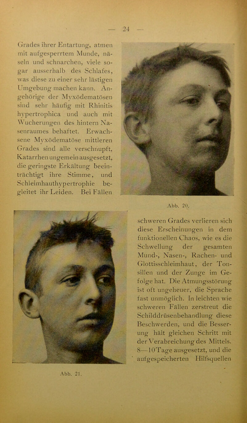 Grades ihrer Entartung, atmen Ö 7 mit aufgesperrtem Munde, nä- seln und schnarchen, viele so- gar ausserhalb des Schlafes, was diese zu einer sehr lästigen Umgebung machen kann. An- gehörige der Mvxödematösen sind sehr häufig mit Rhinitis hypertrophica und auch mit Wucherungen des hintern Na- senraumes behaftet. Erwach- sene Myxödematöse mittleren Grades sind alle verschnupft, Katarrhen ungemein ausgesetzt, die geringste Erkältung beein- t) O O trächtigt ihre Stimme, und Schleimhauthypertrophie be- gleitet ihr Leiden. Bei Fällen Abb. 20. schweren Grades verlieren sich diese Erscheinungen in dem funktionellen Chaos, wie es die Schwellung der gesamten Mund-, Nasen-, Rachen- und Glottisschleimhaut, der Ton- sillen und der Zunge im Ge- o folge hat. Die Atmungsstörung ist oft ungeheuer, die Sprache fast unmöglich. In leichten wie schweren Fällen zerstreut die Schilddrüsenbehandlung diese Beschwerden, und die Besser- ung hält gleichen Schritt mit der Verabreichung des Mittels. 8—lOTage ausgesetzt, und die aufgespeicherten Hilfsquellen Abb. 21.