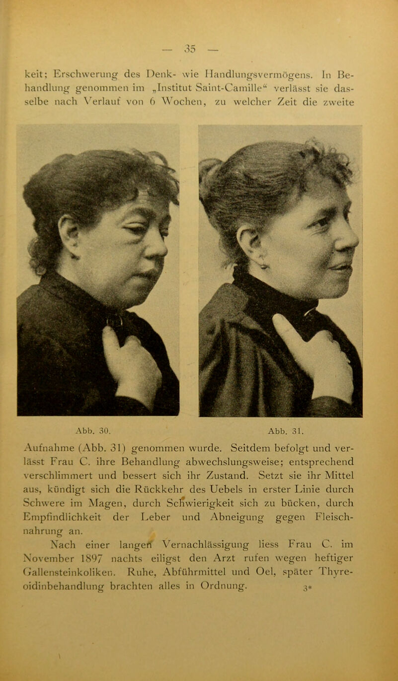 keit; Erschwerung des Denk- wie Handlungsvermögens. In Be- handlung genommen im „Institut Saint-Camille“ verlässt sie das- selbe nach Verlauf von 6 Wochen, zu welcher Zeit die zweite Abb. 30. Abb. 31. Aufnahme (Abb. 31) genommen wurde. Seitdem befolgt und ver- lässt Frau C. ihre Behandlung abwechslungsweise; entsprechend verschlimmert und bessert sich ihr Zustand. Setzt sie ihr Mittel aus, kündigt sich die Rückkehr des Uebels in erster Linie durch Schwere im Magen, durch Schwierigkeit sich zu bücken, durch Empfindlichkeit der Leber und Abneigung gegen Fleisch- nahrung an. Nach einer langen Vernachlässigung liess Frau C. im November 1897 nachts eiligst den Arzt rufen wegen heftiger Gallensteinkoliken. Ruhe, Abführmittel und Oel, später Thyre- oidinbehandlung brachten alles in Ordnung. 3*