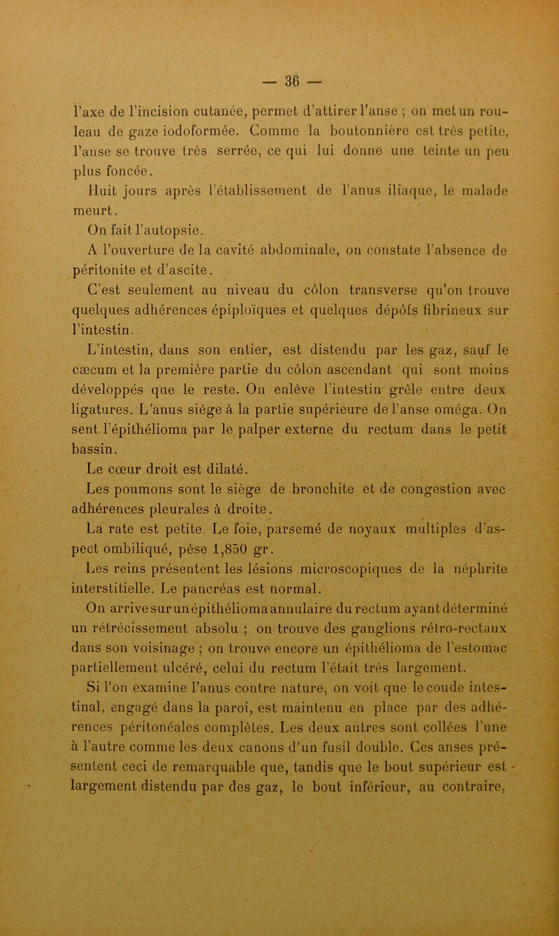 Taxe de l’incision cutanée, permet d’attirer l’anse ; on met un rou- leau de gaze iodoformée. Comme la boutonnière est très petite, l’anse se trouve très serrée, ce qui lui donne une teinte un peu pins foncée. Huit jours après l’établissement de l’anus iliaque, le malade meurt. ün fait l’autopsie. A l’ouverture de la cavité abdominale, on constate l’absence de péritonite et d’ascite. C’est seulement au niveau du côlon transverse qu’on trouve quelques adhérences épiploïques et quelques dépôts fibrineux sur l’intestin. L’intestin, dans son entier, est distendu par les gaz, sauf le cæcum et la première partie du côlon ascendant qui sont moins développés que le reste. On enlève l’intestin grêle entre deux ligatures. L’anus siégea la partie supérieure de l’anse oméga. On sent, l’épithélioma par le palper externe du rectum dans le petit bassin. Le cœur droit est dilaté. Les poumons sont le siège de bronchite et de congestion avec adhérences pleurales à droite. La rate est petite. Le foie, parsemé de noyaux multiples d’as- pect ombiliqué, pèse 1,850 gr. Les reins présentent les lésions microscopiques de la néphrite interstitielle. Le pancréas est normal. On arrivesurunépithéliomaannulaire du rectum ayant déterminé un rétrécissement absolu ; on trouve des ganglions rétro-rectaux dans son voisinage ; on trouve encore un épithélioma de l’estomac partiellement ulcéré, celui du rectum l’était très largement. Si l’on examine l’anus contre nature, on voit que le coude intes- tinal, engagé dans la paroi, est maintenu en place par des adhé- rences péritonéales complètes. Les deux autres sont collées l’une à l’autre comme les deux canons d'un fusil double. Ces anses pré- sentent ceci de remarquable que, tandis que le bout supérieur est - largement distendu par des gaz, le bout inférieur, au contraire.