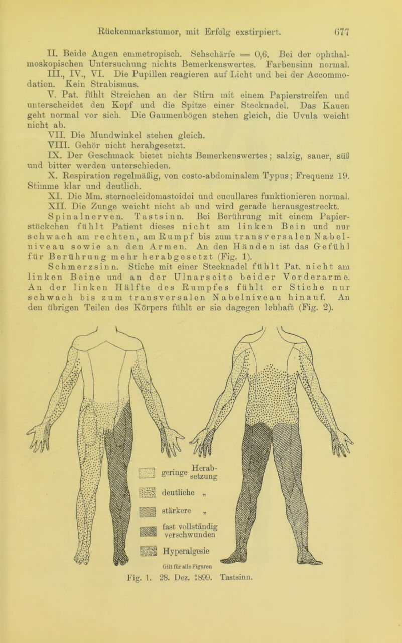 II. Beide Augen emmetropisch. Sehscliäi’fe = 0,0. Bei der ophthal- moskopischen Untersuchung nichts Bemerkenswertes. Farbensinn normal. III. , IV., VI. Die Pupillen reagieren auf Licht und bei der Accommo- dation. Kein Strabismus. V. Pat. fühlt Streichen an der Stirn mit einem Papierstreifen und unterscheidet den Kopf und die Spitze einer Stecknadel. Das Kauen geht normal vor sich. Die Gaumenbögen stehen gleich, die Uvula weicht nicht ab. VII. Die Mundwinkel stehen gleich. VIII. Gehör nicht herabgesetzt. IX. Der Geschmack bietet nichts Bemerkenswertes; salzig, sauer, süß und bitter werden unterschieden. X. Respiration regelmäßig, von costo-abdominalem Typus; Fi’equenz 19. Stimme klar und deutlich. XI. Die Mm. sternocleidomastoidei und cucullares funktionieren normal. XII. Die Zunge weicht nicht ab und wird gerade herausgestreckt. Spinalnerven. Tastsinn. Bei Berührung mit einem Papier- stückchen fühlt Patient dieses nicht am linken Bein und nur schwach am rechten, am Rumpf bis zum transversalen Nabel- niveau sowie an den Armen. An den Händen ist das Gefühl für Berührung mehr herabgesetzt (Fig. 1). Schmerzsinn. Stiche mit einer Stecknadel fühlt Pat. nicht am linken Beine und an der Ulnarseite beider Vorderarme. An der linken Hälfte des Rumpfes fühlt er Stiche nur schwach bis zum transversalen Nabelniveau hinauf. An den übrigen Teilen des Körpers fühlt er sie dagegen lebhaft (Fig. 2). Herab- Setzung deutliche „ stärkere „ fast vollständig verschwunden Hyperalgesie Gilt für alle Figuren