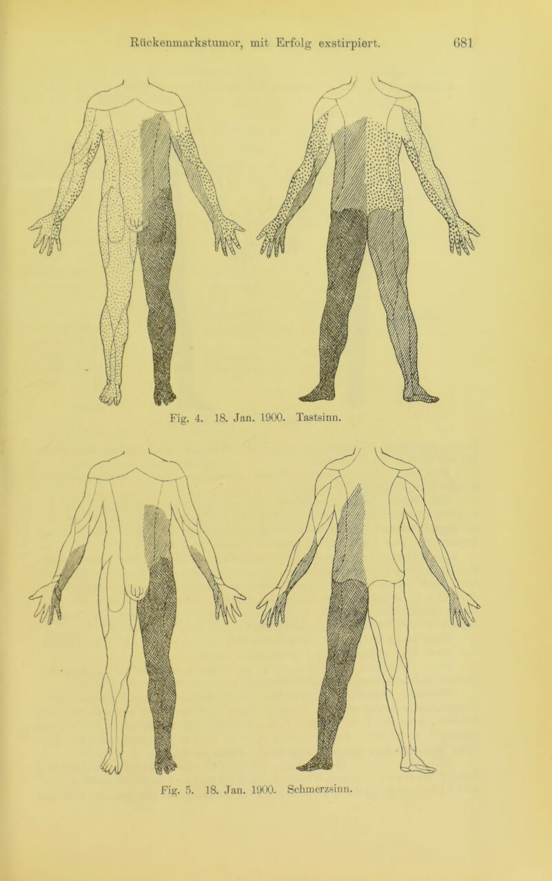 Fig. 5. 18. .Tan. 1900. Schmcrzsinn.