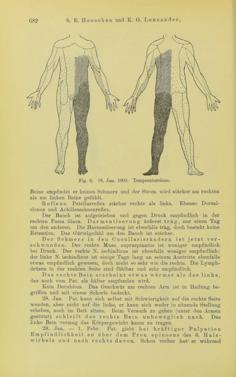 Fig. 6. 18. Jan. 1900. Temperatursinne. Beine empfindet er keinen Schmerz und der Strom wird stärker am rechten als am linken Beine gefühlt. Reflexe. Patellarreflex stärker rechts als links. Ebenso Dorsal- clonus und Achillessehnenreflex. Der Bauch ist aufgetrieben und gegen Druck empfindlich in der rechten Eossa iliaca. Darmentleerung äußerst trag, nur einen Tag um den anderen. Die Harnentleerung ist ebenfalls trag, doch besteht keine Retention. Das Gürtelgefühl um den Bauch ist stärker. Der Schmerz in den Cucullarisrändern ist jetzt ver- schwunden. Der rechte Muse, supraspinatus ist weniger empfindlich bei Druck. Der rechte N. ischiadicus ist ebenfalls weniger empfindlich; der linke N. ischiadicus ist einige Tage lang an seinem Austritte ebenfalls etwas empfindlich gewesen, doch nicht so sehr wie die rechte. Die Lymph- drüsen in der rechten Seite sind fühlbar und sehr empfindlich. Das rechte Bein erscheint etwas wärmer als das linke, das auch vom Rat. als kälter empfunden wird. Kein Decubitus. Das Geschwür am rechten Arm ist in Heilung be- griffen und mit einem Schorfe bedeckt. 28. Jan. Rat. kann sich selbst mit Schwierigkeit auf die rechte Seite wenden, aber nicht auf die linke, er kann sich weder in sitzende Stellung erheben, noch im Bett sitzen. Beim Versuch zu gehen (unter den Armen gestützt) schleift das rechte Bein unbeweglich nach. Das linke Bein vermag das Körpergewicht kaum zu tragen. 28. Jan. — 1. Febr. Rat. giebt bei kräftiger Ralpation Empfindlichkeit an über dem Rroc. spinosus des 6. Hals- wirbels und nach rechts davon. Schon vorher hat' er während