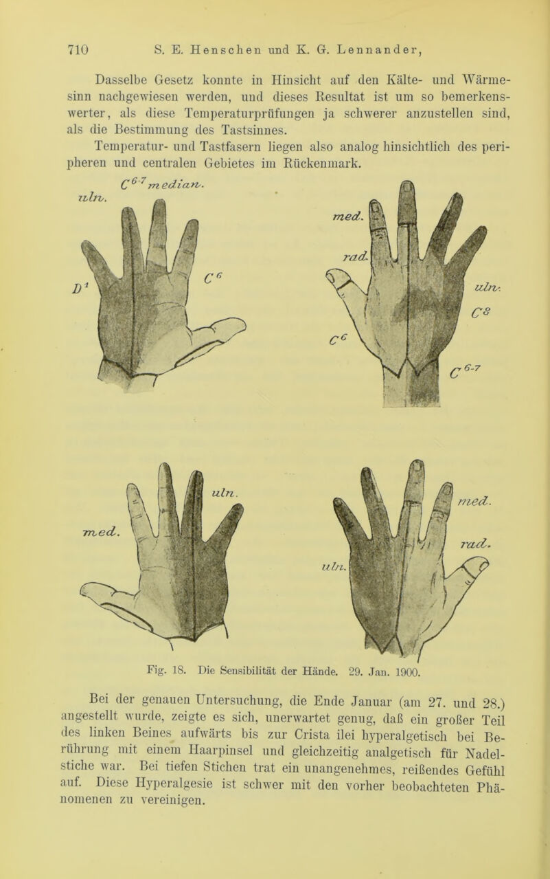 Dasselbe Gesetz konnte in Hinsicht auf den Kälte- und Wärme- sinn nacligewiesen werden, und dieses Resultat ist um so bemerkens- werter, als diese Temperaturprüfungen ja schwerer anzustellen sind, als die Bestimmung des Tastsinnes. Temperatur- und Tastfasern liegen also analog hinsichtlich des peri- pheren und centralen Gebietes im Rückenmark. med. ubi. rad. Fig. 18. Die Sensibilität der Hände. 29. Jan. 1900. Bei der genauen Untersuchung, die Ende Januar (am 27. und 28.) angestellt wurde, zeigte es sich, unerwartet genug, daß ein großer Teil des linken Beines aufwärts bis zur Crista ilei hyperalgetisch bei Be- rührung mit einem Haarpinsel und gleichzeitig analgetisch für Nadel- stiche war. Bei tiefen Stichen trat ein unangenehmes, reißendes Gefühl auf. Diese Hyperalgesie ist schwer mit den vorher beobachteten Phä- nomenen zu vereinigen.
