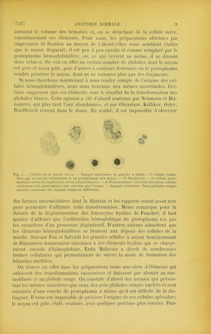 ê ï W] ANATOMIE NORMALE t> aurauMil h' voUmu' dos hônialii's o(, on so dôtaoliani do la collnh' inoro, oonstiluoraionl cos ôlômonls. l’onr nous, los prôpacations olitonnos pai' improssion ot fixai ion an moNon di' l'alcool-ôllu'c noos sonihlonl ôlaldir ([iio lo noyau dispaixiit; il l'st [lou à pou (Mivalii ot conuno l'omplacô par lo liroloplasina liômoj2,lol)initoro, on, co iiui rovioni an inôino, il so dissout dans colui-ci. On voit imi oIVoI un coi lain noinltro di' lilohnlos dont lo no\au osl ^Tos ol assoz pàlo, [mis d'anin's à contours t'ostonnôs oii lo [iroloplasma soinlilo pônôtror lo noyau, dont on no rotronvo [ilns (jiio dos l'ragnionls. Si nous chorclions inaintonant à nous rondro compto do rori<ïino dos col- Inlos lidnn\iïlol)inirôros, nous nous lionrions aux inômos incortitndos. Cor- tains sii{)posont (|iio cos ôlôinonts sont lo rosiillat do la Iransl'orination dos iilohulos blancs. Cotto 0[)inion a ôtô d'abord soutonno [lar Nonmann ol Biz- zozzoï'o, ipii plus lard font abandonnôo, ol par Obrastzov. Küllikor, Osb'r, Hindlloiscli roslont dans lo donto. En rôalitô, il osl inijiossiblo d'obsorvor Kig. 1. — Cellules de lu moelle des os. — Kangéc supéricuro de gauche à droite : l Cellule consti- tuée par un noyau volumineux et un protoplasina très mince. — 2“ Myélocyte. — 3 Cellule inter- médiaire entre los myélocytes ot les polynucléaires. — 1” Polynucléaire. Ces trois dernières cellules- renferment des granulations non colorées par l'éosine. — Rangée inférieure. Trois globules rouges nucléés contenant des noyau.x d'aspects dilfércnts. # des formes intormédiairos dont la lilialion cl les rajipoiTs soient assez nets pour pormotlro d'aflirmor colle transformation. Même ]'cman|nc pour la théorie do la dégonérescenco dos leucocytes hyalins do Ponchet; il faut ajouter d'aillours ijiio rinlillralion hémoglobiiiuo du protoplasina n'a pas les caractères d'un processus dégénératif. D'autres auteurs admellmit (|ue les éléments hémoglohiiiiféres se forment aux dé[)Ous des cellules de la moelle. Suivant Foa et Sah ioli les grandes cellules à noyau hoiirgeoimant de Bizzozzero donneraient naissance à des éléments byalins (pii se cliarge- raienl ensuite d'hémoglobine. Enlin Malasscz a décrit de nombreuses formes cellulaires (|ui pcrmcllraienl de suivre la mode de formation des hématies nucléées. On trouve en ell'et dans les préparations tonte une série d'éléments ipii subissent des transformations successives et tinissmil par aboutir au nor- moblasle et au globule rouge. On constate d'abord des noyaux ipii [iréseii- lanl les mêmes caractères (|iie ceux des gros globules rouges nucléés et sont entourés d'une couche de protoplasina si mince (pi'il est ditlicile de la dis- tinguer. Il nous est impossible de préciser l’origine de ces cellules s|)éciales; le noyau est pâle, étalé, o\alaire, avec (piebjiies portions plus foncées. Puis