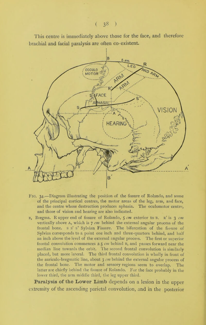 This centre is immediately above those for the face, and therefore brachial and facial paralysis are often co-existent. Fig. 34.—Diagram illustrating the position of the fissure of Rolando, and some of the principal cortical centres, the motor areas of the leg, arm, and face, and the centre whose destruction produces aphasia. The oculomotor centre, and those of vision and hearing are also indicated, i?, Bregma. R upper end of fissure of Rolando, 5 cm exterior to B. r' is 3 cm vertically above A, which is 7 cm behind the external angular process of the frontal bone, s s' s Sylvian Fissure. The bifurcation of the fissure of Sylvius corresponds to a point one inch and three-quarters behind, and half an inch above the level of the external angular process. The first or superior frontal convolution commences 2.5 cm behind u, and passes forward near the median line towards the orbit. The second frontal convolution is similarly placed, but more lateral. The third frontal convolution is wholly in front of the auriculo-bregmatic line, about 3 cm behind the external angular process of the frontal bone. The motor and sensory regions seem to overlap. The latter are chiefly behind the fissure of Rolando. For the face probably in the lower third, the arm middle third, the leg upper third. Paralysis of the Lower Limb depends on a lesion in the upper extremity of the ascending parietal convolution, and in the posterior