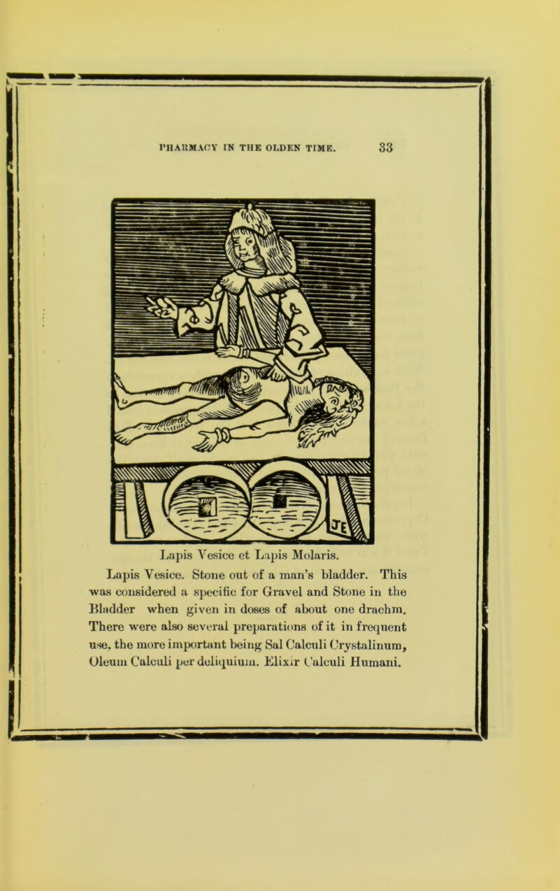 Lapis Ve.sice et Lijiis Molaris. Lapis Vesice. Stone out of a man’s bladder. This was considered a s}x;cific for Gravel and Stone in the Bladder when given in doses of about one drachm. There were also several preparations of it in freijuent use. the more iinporbmt being Sal Calculi Cry.stalinum, Oleum Calculi per dcliquium. Elixir (.'alculi Humani.
