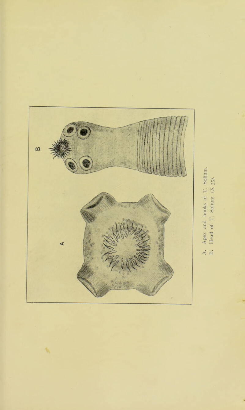 < CQ Apex and hooks of T. Solium. Head of T. Solium (X 35).