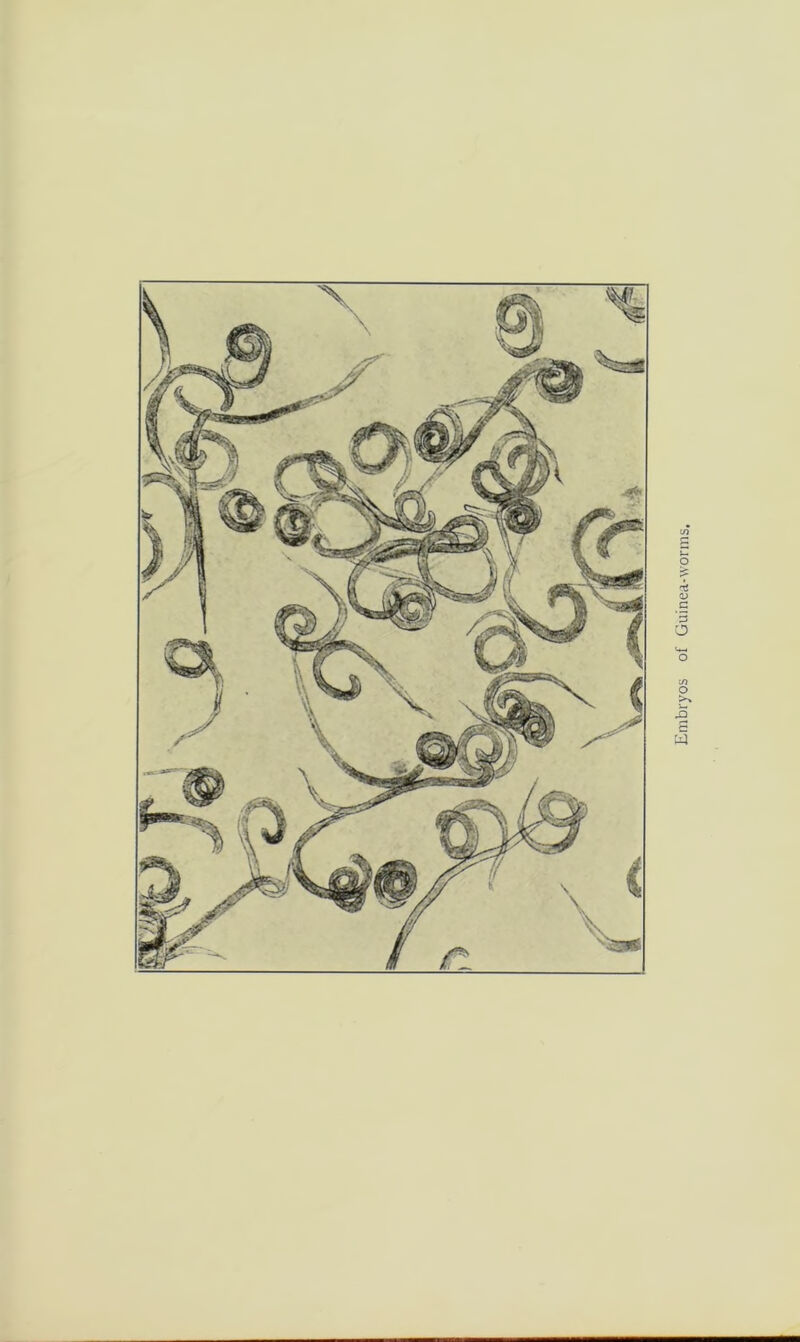 Embryos of Guinea-worms.