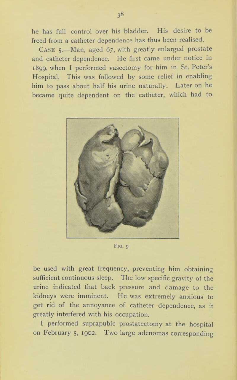 he has full control over his bladder. His desire to be freed from a catheter dependence has thus been realised. Case 5.—Man, aged 67, with greatly enlarged prostate and catheter dependence. He first came under notice in 1899, when I performed vasectomy for him in St. Peter’s Hospital. This was followed by some relief in enabling him to pass about half his urine naturally. Later on he became quite dependent on the catheter, which had to Fig. 9 be used with great frequency, preventing him obtaining sufficient continuous sleep. The low specific gravity of the urine indicated that back pressure and damage to the kidneys were imminent. He was extremely anxious to get rid of the annoyance of catheter dependence, as it greatly interfered with his occupation. I performed suprapubic prostatectomy at the hospital on February 5, 1902. Two large adenomas corresponding