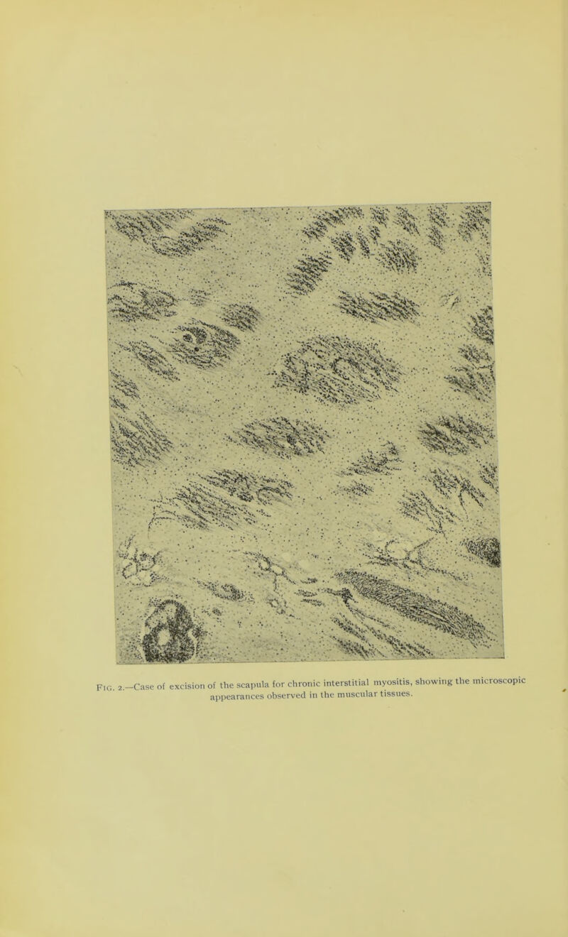 appearances observed in the muscular tissues.