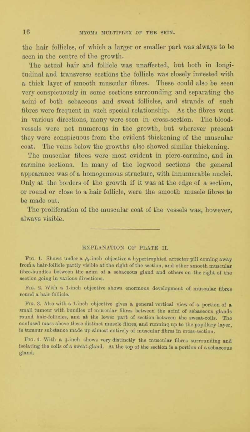 the hair follicles, of which a larger or smaller part was always to be seen in the centre of the growth. The actual hair and follicle was unaffected, but both in longi- tudinal and transverse sections the follicle was closely invested with a thick layer of smooth muscular fibres. These could also be seen very conspicuously in some sections surrounding and separating the acini of both sebaceous and sweat follicles, and strands of such fibres were frequent in such special relationship. As the fibres went in various directions, many were seen in cross-section. The blood- vessels were not numerous in the growth, but wherever present they were conspicuous from the evident thickening of the muscular coat. The veins below the growths also showed similar thickening. The muscular fibres were most evident in picro-carmine, and in carmine sections. In many of the logwood sections the general appearance was of a homogeneous structure, with innumerable nuclei. Only at the borders of the growth if it was at the edge of a section, or round or close to a hair follicle, were the smooth muscle fibres to be made out. The proliferation of the muscular coat of the vessels was, however, always visible. EXPLANATION OF PLATE II. Fig. 1. Shows under a yff-inch objective a hypertrophied arrector pili coming away from a hair-follicle partly visible at the right of the section, and other smooth muscular fibre-bundles between the acini of a sebaceous gland and others on the right of the section going in various directions. Fig. 2. With a 1-inch objective shows enormous development of muscular fibres round a hair-follicle. Fig. 3. Also with a 1-inch objective gives a general vertical view of a portion of a small tumour with bundles of muscular fibres between the acini of sebaceous glands round hair-follicles, and at the lower part of section between the sweat-coils. The confused mass above these distinct muscle fibres, and running up to the papillary layer, is tumour substance made up almost entirely of muscular fibres in cross-section. Fig. 4. With a £-inch shows very distinctly the muscular fibres surrounding and isolating the coils of a sweat-gland. At the top of the section is a portion of a sebaceous gland.