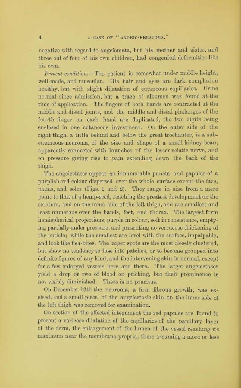 negative with regard to angeiomata, but his mother and sister, and three out of four of his own children, had congenital deformities like his own. Present condition.—The patient is somewhat under middle height, well-made, and muscular. His hair and eyes are dark, complexion healthy, but with slight dilatation of cutaneous capillaries. Urine normal since admission, but a trace of albumen was found at the time of application. The fingers of both hands are contracted at the middle and distal joints, and the middle and distal phalanges of the fourth finger on each hand are duplicated, the two digits being enclosed in one cutaneous investment. On the outer side of the right thigh, a little behind and below the great trochanter, is a sub- cutaneous neuroma, of the size and shape of a small kidney-bean, apparently connected with branches of the lesser sciatic nerve, and on pressure giving rise to pain extending down the back of the thigh. The angeiectases appear as innumerable puncta and papules of a purplish-red colour dispersed over the whole surface except the face, palms, and soles (Figs. 1 and 2). They range in size from a mere point to that of a hemp-seed, reaching the greatest development on the scrotum, and on the inner side of the left thigh, and are smallest and least numerous over the hands, feet, and thorax. The largest form hemispherical projections, purple in colour, soft in consistence, empty- ing partially under pressure, and presenting no verrucose thickening of the cuticle; while the smallest are level with the surface, impalpable, and look like flea-bites. The larger spots are the most closely clustered, but show no tendency to fuse into patches, or to become grouped into definite figures of any kind, and the intervening skin is normal, except for a few enlarged vessels here and there. The larger angeiectases yield a drop or two of blood on pricking, but their prominence is not visibly diminished. There is no pruritus. On December 13th the neuroma, a firm fibrous growth, was ex- cised, and a small piece of the angeiectasic skin on the inner side of the left thigh was removed for examination. On section of the affected integument the red papules are found to present a varicose dilatation of the capillaries of the papillary layer of the derm, the enlargement of the lumen of the vessel reaching its maximum near the membrana propria, there assuming a more or less