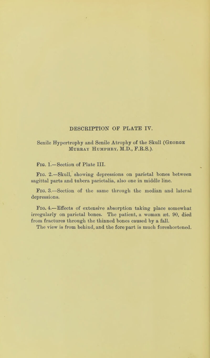 Senile Hypertrophy and Senile Ati-ophy of the Skull (George Murray Humphry, M.D., F.R.S.). Fig. 1.— Section of Plate III. Fig. 2.—Skull, showing depressions on parietal bones between sagittal parts and tubera parietalia, also one in middle line. Fig. 3.—Section of the same through the median and lateral depressions. Fig. 4.—Effects of extensive absorption taking place somewhat irregularly on parietal bones. The patient, a woman set. 90, died from fractures through the thinned bones caused by a fall. The view is from behind, and the forepart is much foreshortened.
