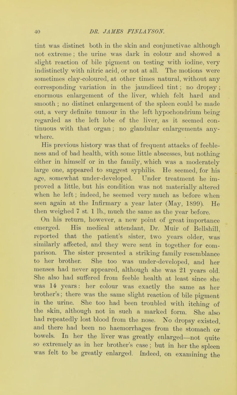 tint was distinct both in the skin and conjunctivae although not extreme ; the urine was dark in colour and showed a slight reaction of bile pigment on testing with iodine, very indistinctly with nitric acid, or not at all. The motions were sometimes clay-coloured, at other times natural, without any corresponding variation in the jaundiced tint; no dropsy ; enormous enlargement of the liver, which felt hard and smooth ; no distinct enlargement of the spleen could be made out, a very definite tumour in the left hypochondrium being regarded as the left lobe of the liver, as it seemed con- tinuous with that organ ; no glandular enlargements any- where. His previous history was that of frequent attacks of feeble- ness and of bad health, with some little abscesses, but nothing either in himself or in the family, which was a moderately large one, appeared to suggest syphilis. He seemed, for his age, somewhat under-developed. Under treatment he im- proved a little, but his condition was not materially altered when he left; indeed, he seemed very much as before when seen again at the Infirmary a year later (May, 1899). He then weighed 7 st. 1 lb., much the same as the year before. On his return, however, a new point of great importance emerged. His medical attendant, Dr. Muir of Bellshill, reported that the patient’s sister, two years older, was similarly affected, and they were sent in together for com- parison. The sister presented a striking family resemblance to her brother. She too was under-developed, and her menses had never appeared, although she was 21 years old. She also had suffered from feeble health at least since she was 14 years: her colour was exactly the same as her brother’s; there was the same slight reaction of bile pigment in the urine. She too had been troubled with itching of the skin, although not in such a marked form. She also had repeatedly lost blood from the nose. No dropsy existed, and there had been no haemorrhages from the stomach or bowels. In her the liver was greatly enlarged—not quite so extremely as in her brother’s case ; but in her the spleen was felt to be greatly enlarged. Indeed, on examining the
