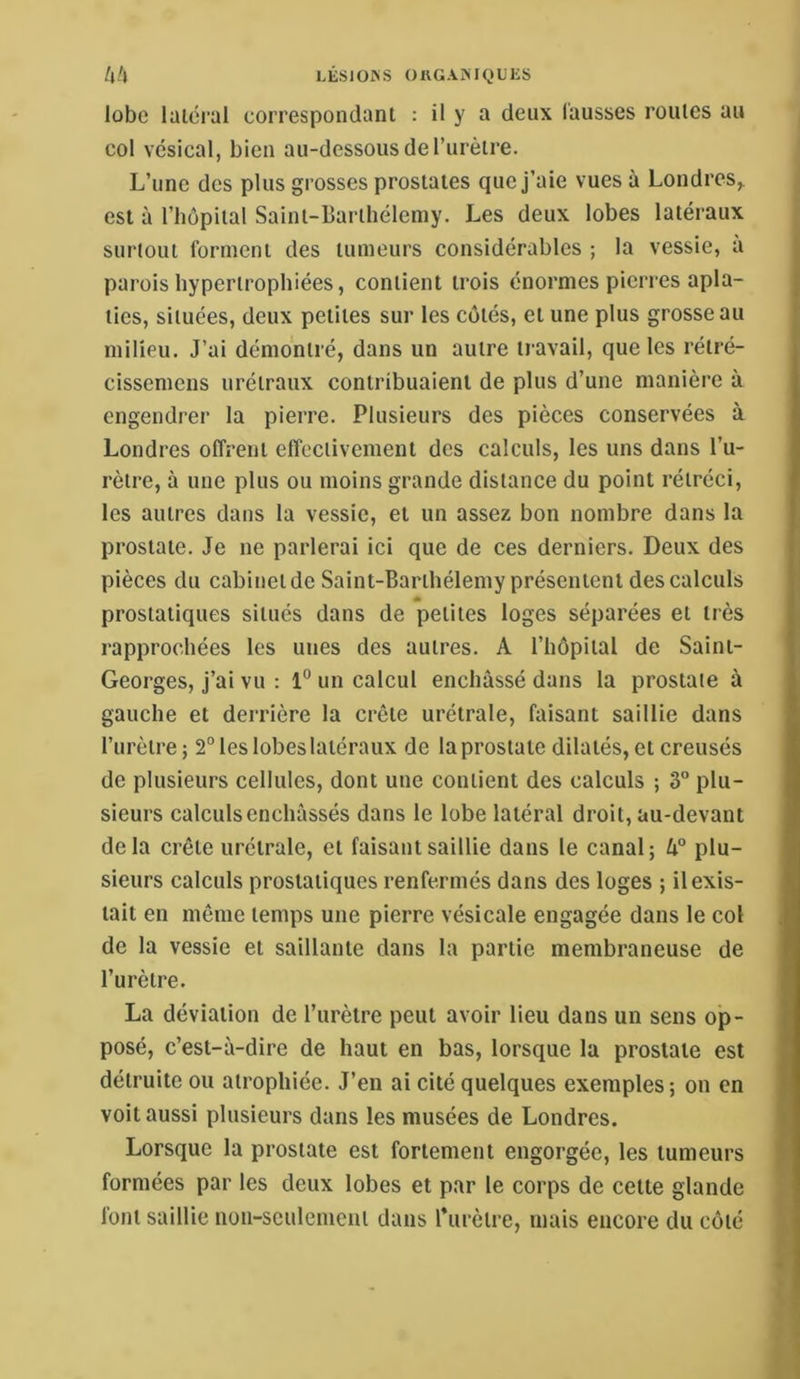 lobe laici’al correspondant : il y a deux fausses roules au col vésical, bien au-dessous de Turèire. L’une des plus grosses prostates que j’aie vues à Londres,, est à l’hôpital Saint-Barthélemy. Les deux lobes latéraux surtout forment des tumeurs considérables ; la vessie, à parois hypertrophiées, contient trois énormes pierres apla- ties, situées, deux petites sur les côtés, et une plus grosse au milieu. J’ai démontré, dans un autre travail, que les rétré- cissemens urélraux contribuaient de plus d’une manière à engendrer la pierre. Plusieurs des pièces conservées à Londres offrent effectivement des calculs, les uns dans l’u- rèire, à une plus ou moins grande distance du point rétréci, les autres dans la vessie, et un assez bon nombre dans la prostate. Je ne parlerai ici que de ces derniers. Deux des pièces du cabinet de Saint-Barthélemy présentent des calculs prostatiques situés dans de petites loges separees et 1res rapprochées les unes des autres. A l’hôpital de Saint- Georges, j’ai vu : 1“ un calcul enchâssé dans la prostate à gauche et derrière la crête urétrale, faisant saillie dans l’urètre; 2° les lobes latéraux de la prostate dilatés, et creusés de plusieurs cellules, dont une contient des calculs ; 3” plu- sieurs calculs enchâssés dans le lobe latéral droit, au-devant delà crête urétrale, et faisant saillie dans le canal; U° plu- sieurs calculs prostatiques renfermés dans des loges ; il exis- tait en même temps une pierre vésicale engagée dans le col de la vessie et saillante dans la partie membraneuse de l’urètre. La déviation de l’urètre peut avoir lieu dans un sens op- posé, c’est-à-dire de haut en bas, lorsque la prostate est détruite ou atrophiée. J’en ai cité quelques exemples; on en voit aussi plusieurs dans les musées de Londres. Lorsque la prostate est fortement engorgée, les tumeurs formées par les deux lobes et par le corps de cette glande font saillie non-seulement dans rurèlre, mais encore du côté