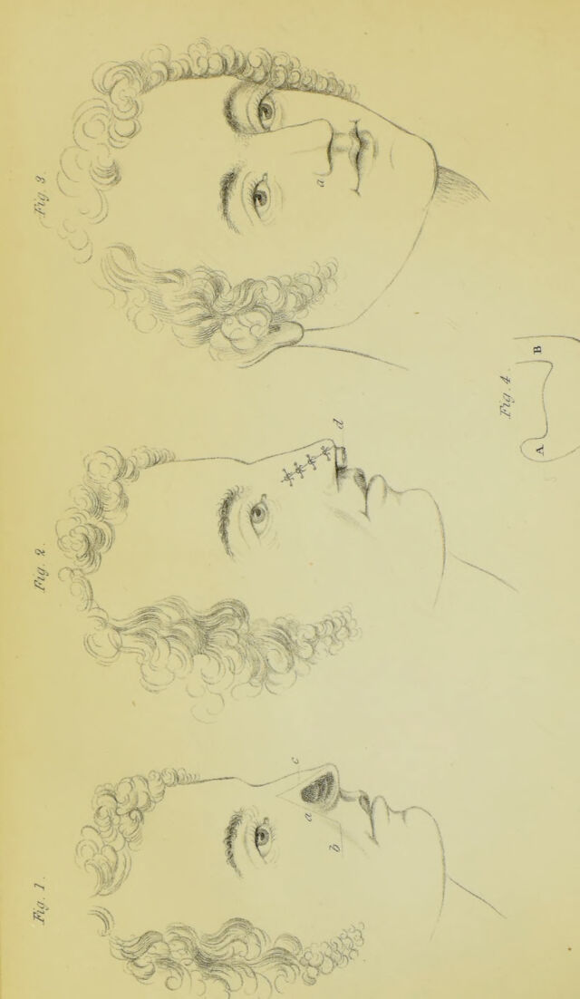 digitised image 2