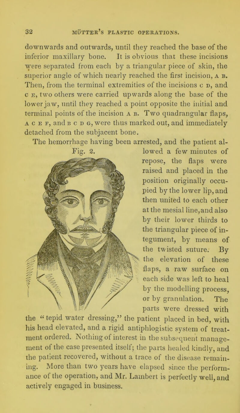 downwards and outwards, until they reached the base of the inferior maxillary bone. It is obvious that these incisions were separated from each by a triangular piece of skin, the superior angle of which nearly reached the first incision, a b. Then, from the terminal extremities of the incisions c d, and c e, two others were carried upwards along the base of the lower jaw, until they reached a point opposite the initial and terminal points of the incision a b. Two quadrangular flaps, a c e f, and b c d g, were thus marked out, and immediately detached from the subjacent bone. The hemorrhage having been arrested, and the patient al- lowed a few minutes of repose, the flaps were raised and placed in the position originally occu- pied by the lower lip, and then united to each other at the mesial line,and also by their lower thirds to the triangular piece of in- tegument, by means of the twisted suture. By the elevation of these flaps, a raw surface on each side was left to heal by the modelling process, or by granulation. The parts were dressed with the “ tepid water dressing,” the patient placed in bed, with his head elevated, and a rigid antiphlogistic system of treat- ment ordered. Nothing of interest in the subsequent manage- ment of the case presented itself; the parts healed kindly, and the patient recovered, without a trace of the disease remain- ing. More than two years have elapsed since the perform- ance of the operation, and Mr. Lambert is perfectly well, and actively engaged in business.