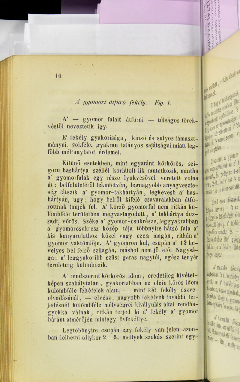 A' — gyomor falait átfúrni — túlságos törek- véstől neveztetik igv. E’ fekély gyakorisága, kinzó és súlyos lámaszt- mányai. sokféle, gyakran talányos sajátságai miatt leg- főbb méltánylalot érdemel. Kitűnő esetekben, mint egyaránt körkörös, szi- gorú hashártya széliéi korlátolt lik mutatkozik, mintha a’ gyomorfalak egy része lyukvésövel veretett volna át; belfelületéröl tekintetvén, legnagyobb anyagveszte- ség látszik a’ gyomor-takhártyán, legkevesb a’ has- hártyán, úgy: hogy beiről kifelé csavaralakban átfú- rottnak tűnjék fel. A’ körző gyomorfal nem ritkán kü- lömbféle területben megvastagodott, a’ takhártya duz- zadt, vörös. Széke a' gyomor-csukrésze, leggyakrabban a’ gyomorcsukrész közép tája többnyire hátsó fala a’ kis kanyarulathoz közel vagy ezen magán, ritkán a’ gyomor vaktömlője. A’ gyomron kül, csupán a’ 12 hü- velyes bél felső szilagán, máshol nem jő elő. Nagysá- ga: a’ leggyakoribb ezüst garas nagytól, egész tenyér területűig különbözik. A’ rendszerint körkörös idom , eredetileg kivétel- képen szabálytalan, gyakoriabban az elein körös idom külömbféle feltételek alatt, — mint két fekély öszve- olvadásánál, — elvész; nagyobb fekélyek további ter- jedésnél külömbféle mélységiéi kivályulás által rendha- gyókká válnak, ritkán terjed ki a’ fekély a’ gyomor háránt átmérőjén mintegy övfekéllyé. Legtöbbnyire csupán egy fekély van jelen azon- ban lelhetni ollykor 2 — 5, mellyek szokás szerint egy-