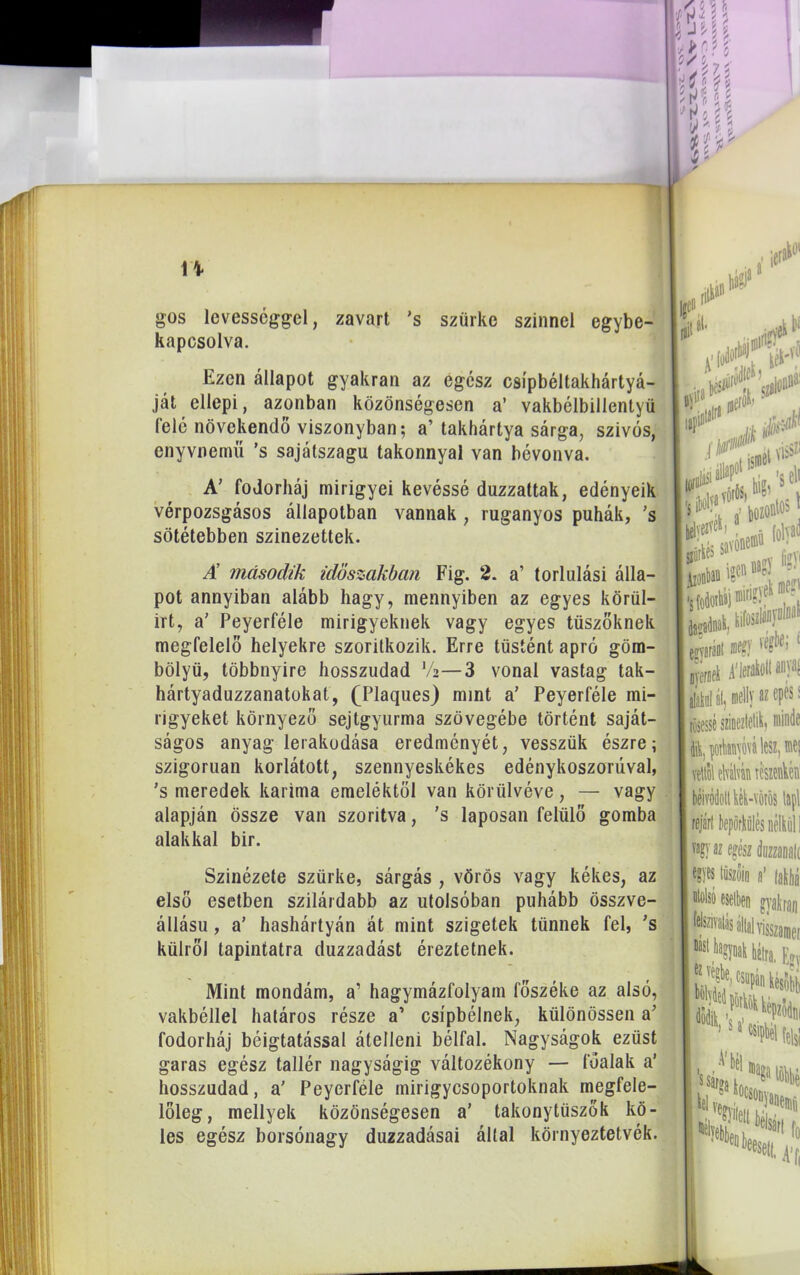 gos lcvesscggel, zavart 's szürke színnel egybe- kapcsolva. Ezen állapot gyakran az egész csípbéltakhártyá- ját ellepi, azonban közönségesen a’ vakbélbillentyü felé növekendó viszonyban; a’ takhártya sárga, szívós, enyvnemü ’s sajátszagu takonnyal van bévonva. A’ fodorháj mirigyei kevéssé duzzattak, edényeik vérpozsgásos állapotban vannak , ruganyos puhák, ’s sötétebben színezettek. A’ második időszakban Fig. 2. a’ torlulási álla- pot annyiban alább hagy, mennyiben az egyes körül- irt, a’ Peyerféle mirigyeknek vagy egyes tüszőknek megfelelő helyekre szorítkozik. Erre tüstént apró göm- bölyű, többnyire hosszudad V*—3 vonal vastag tak- hártyaduzzanatokat, (Plaques) mint a’ Peyerféle mi- rigyeket környező sejtgyurma szövegébe történt saját- ságos anyag lerakodása eredményét, vesszük észre; szigorúan korlátott, szennyeskékes edény koszorúval, ’s meredek karima emelőktől van körülvéve, — vagy alapján össze van szorítva, ’s laposan felülő gomba alakkal bir. Szinézete szürke, sárgás , vörös vagy kékes, az első esetben szilárdabb az utolsóban puhább összve- állásu, a’ hashártyán át mint szigetek tűnnek fel, ’s külről tapintatra duzzadást éreztetnek. Mint mondám, a’ hagymázfolyam főszéke az alsó, vakbéllel határos része a’ csípbélnek, különössen a’ fodorháj béigtatással átelleni bélfal. Nagyságok ezüst garas egész tallér nagyságig változékony — fóalak a’ hosszudad, a' Peyerféle mirigycsoportoknak megfele- lőleg, mellyek közönségesen a’ takonytüszők kö- les egész borsónagy duzzadásai által környeztetvék.