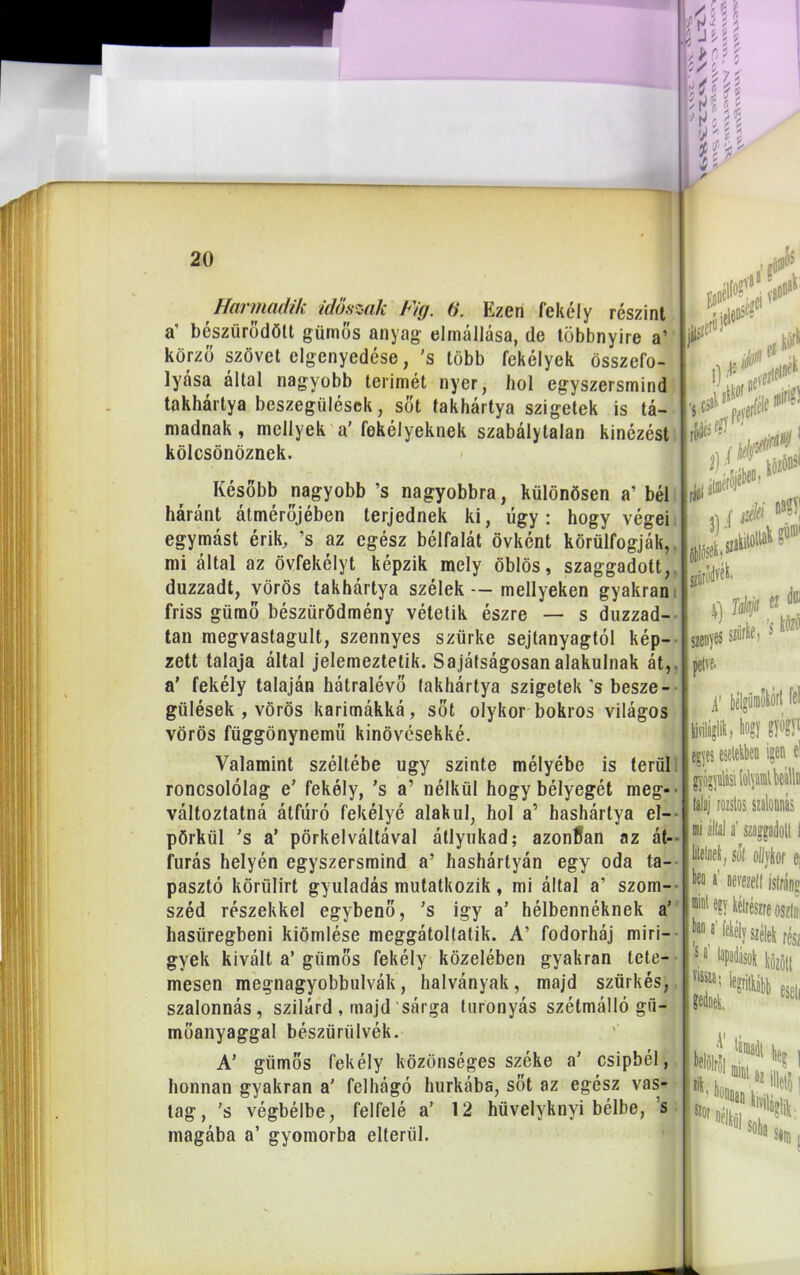 Harmadik időszak Fig. 0. Ezen fekély részint a’ beszűrődött gümös anyag elmállása, de többnyire a’ körző szövet elgenyedése, 's több fekélyek összefo- lyása által nagyobb térimét nyer, hol egyszersmind takhártya beszegülések, sőt takhártya szigetek is tá- madnak , mellyek a’ fekélyeknek szabálytalan kinézést kölcsönöznek. Később nagyobb ’s nagyobbra, különösen a’ bél háránt átmérőjében terjednek ki, úgy: hogy végei egymást érik, ’s az egész bélfalát övként körülfogják,, mi által az övfekélyt képzik mely öblös, szaggadott, duzzadt, vörös takhártya szélek — mellyeken gyakran friss gümő bésziirödmény vétetik észre — s duzzad- tan megvastagult, szennyes szürke sejtanyagtól kép- zett talaja által jelemeztetik. Sajátságosán alakulnak át,. a’ fekély talaján hátralévő takhártya szigetek ‘s besze- gülések , vörös karimákká, sőt olykor bokros világos vörös függönynemíí kinövésekké. Valamint széltébe úgy szinte mélyébe is terül roncsolólag e’ fekély, ’s a’ nélkül hogy bélyegét meg-' változtatná átfúró fekélyé alakul, hol a’ hashártya el- pörkül ’s a’ pörkelváltával átlyukad; azonban az át- fúrás helyén egyszersmind a’ hashártyán egy oda ta- pasztó körülirt gyuladás mutatkozik, mi által a’ szom- széd részekkel egybenő, ’s igy a’ hélbennéknek a’ hasüregbeni kiömlése meggátoltatok. A’ fodorháj miri- gyek kivált a’ gürnős fekély közelében gyakran tete- mesen megnagyobbulvák, halványak, majd szürkés, szalonnás, szilárd, majd sárga turönyás szétmálló gii- müanyaggal bészüriilvék. A’ giimős fekély közönséges széke a’ csipbél, honnan gyakran a' felhágó hurkába, sőt az egész vas- tag, ’s végbélbe, felfelé a’ 12 hüvelyknvi bélbe, s magába a’ gyomorba elterül. A' bélgümőkórt fel Svilá|lik, hogy gyógyt egyes eseteiben 'Ben el i ,» . * i 11 'ti lalaj rozstos szalonnás mi állal a‘ szaggadott I liléinél, sőt olljior ei ben a' nevezel! istráng Ét e?y kélrészre oszlai f®a'ftóy síétek rém 11 Nát ti* 2 w