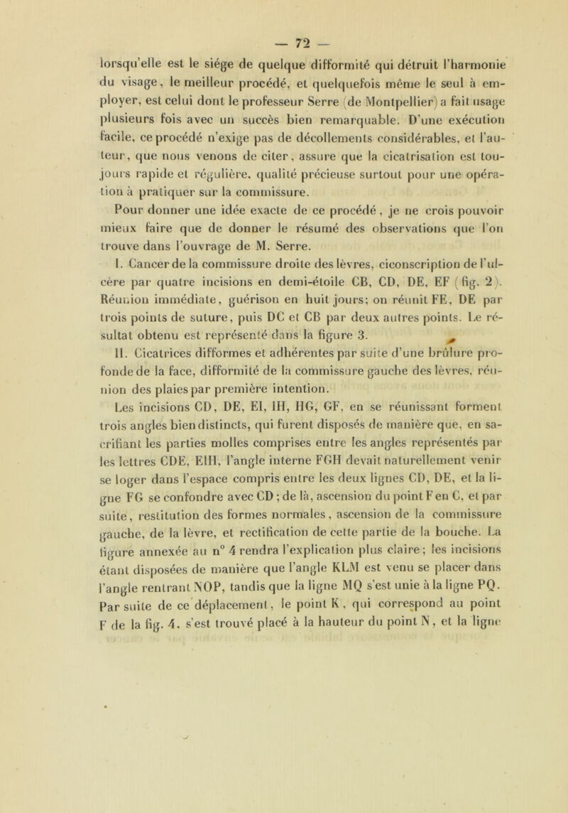 lorsqu’elle est le siège de quelque difformité qui détruit l’harmonie du visage, le meilleur procédé, et quelquefois même le seul à em- ployer, est celui dont le professeur Serre (de Montpellier a fait usage plusieurs fois avec un succès bien remarquable. D’une exécution facile, ce procédé n’exige pas de décollements considérables, et l’au- teur, que nous venons de citer, assure que la cicatrisation est tou- jours rapide et régulière, qualité précieuse surtout pour une opéra- tion à pratiquer sur la commissure. Pour donner une idée exacte de ce procédé, je ne crois pouvoir mieux faire que de donner le résumé des observations que l’on trouve dans l’ouvrage de M. Serre. I. Cancer de la commissure droite des lèvres, ciconscription de l’ul- cère par quatre incisions en demi-étoile CB, CD, DE, EF ( fig. 2 ). Réunion immédiate, guérison en huit jours; on réunit FE, DE par trois points de suture, puis DC et CB par deux autres points. Le ré- sultat obtenu est représenté dans la figure 3. II. Cicatrices difformes et adhérentes par suite d’une brûlure pro- fonde de la face, difformité de la commissure gauche des lèvres, réu- nion des plaies par première intention. Les incisions CD, DE, El, IH, HG, GF, en se réunissant forment trois angles bien distincts, qui furent disposés de manière que, en sa- crifiant les parties molles comprises entre les angles représentés par les lettres CDE, E1H, l’angle interne FGH devait naturellement venir se loger dans l’espace compris entre les deux lignes CD, DE, et la li- gne FG se confondre avec CD ; de là, ascension du point F en C, et par suite, restitution des formes normales, ascension de la commissure gauche, de la lèvre, et rectification de cette partie de la bouche. La ligure annexée au n° 4 rendra l’explication plus claire; les incisions étant disposées de manière que l’angle KLM est venu se placer dans l’angle rentrant NOP, tandis que la ligne MQ s’est unie à la ligne PQ. Par suite de ce déplacement , le point K , qui correspond au point F de la fig. 4, s’est trouvé placé à la hauteur du point N, et la ligne
