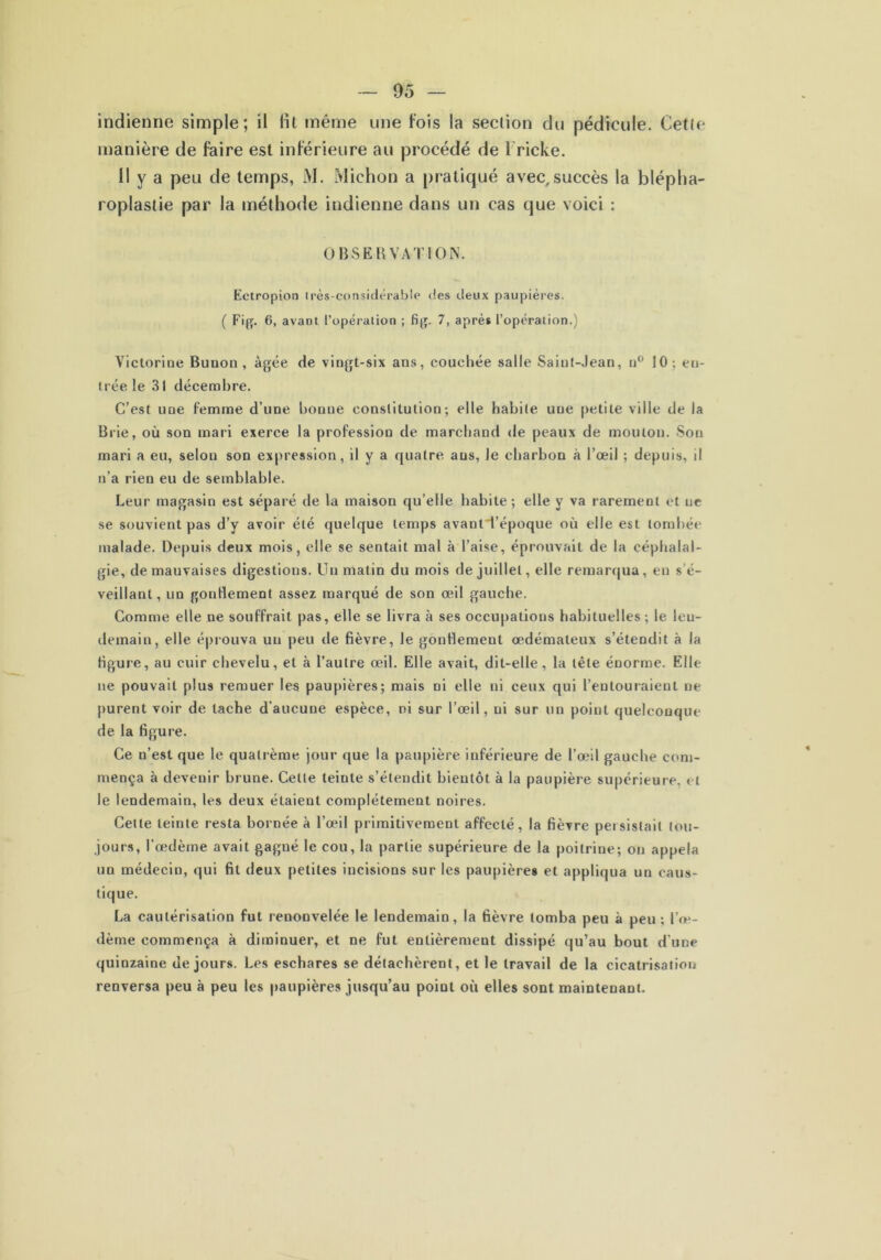 indienne simple; il lit même une fois la section du pédicule. Cette manière de faire est inférieure au procédé de l ricke. Il y a peu de temps, M. Miehon a pratiqué avec,succès la blépha- roplastie par la méthode indienne dans un cas que voici : OBSERVATION. Ectropion très-considérable des deux paupières. ( Fig. 6, avant l'opération ; fi g. 7, après l’opération.) Victorine Buuon , âgée de vingt-six ans, couchée salle Saint-Jean, n° 10; eu- trée le 31 décembre. C’est une femme d’une bonne constitution; elle habile une petite ville de la Brie, où son mari exerce la profession de marchand de peaux de mouton. Son mari a eu, selon son expression, il y a quatre ans, Je charbon à l’œil ; depuis, il n’a rien eu de semblable. Leur magasin est séparé de la maison qu’elle habile; elle y va rarement et ne se souvient pas d’y avoir été quelque temps avantTépoque où elle est tombée malade. Depuis deux mois, elle se sentait mal à l’aise, éprouvait de la céphalal- gie, de mauvaises digestions. Un matin du mois de juillet, elle remarqua, en s’é- veillant, un gonflement assez marqué de son œil gauche. Comme elle ne souffrait pas, elle se livra à ses occupations habituelles; le leu- demain, elle éprouva un peu de fièvre, le gonflement œdémateux s’étendit à la figure, au cuir chevelu, et à l’autre œil. Elle avait, dit-elle, la tête énorme. Elle ne pouvait plus remuer les paupières; mais ni elle ni ceux qui l’entouraient ne purent voir de tache d’aucune espèce, ni sur l’œil, ni sur un point quelconque de la figure. Ce n’est que le quatrème jour que la paupière inférieure de l’œil gauche com- mença à devenir brune. Celte teinte s’étendit bientôt à la paupière supérieure, et le lendemain, les deux étaient complètement noires. Cette teinte resta bornée à l’œil primitivement affecté, la fièvre peisislait tou- jours, l’œdème avait gagué le cou, la partie supérieure de la poitrine; on appela un médecin, qui fit deux petites incisions sur les paupières et appliqua un caus- tique. La cautérisation fut renouvelée le lendemain, la fièvre tomba peu à peu ; l’œ- dème commença à diminuer, et ne fut entièrement dissipé qu’au bout d’une quinzaine de jours. Les eschares se détachèrent, et le travail de la cicatrisation renversa peu à peu les paupières jusqu’au point où elles sont maintenant.