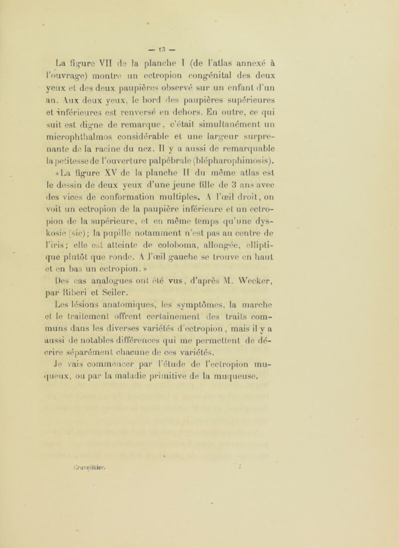 La figure VII ris la planche 1 (de l’atlas annexé à l'ouvrage) montre un ectropion congénital des deux yeux et des deux paupières observé sur un enfant d’un an. Yux deux yeux, le bord des paupières supérieures et inférieures est renversé en dehors. En outre, ce qui suit est digne de remarque, c’était simultanément un microphthalmos considérable et une largeur surpre- nante de la racine du nez. Il y a aussi de remarquable la petitesse de l’ouverture palpébrale (blépharophimosis). «La figure XV de la planche II du même atlas est le dessin de deux yeux d’une jeune fille de 3 ans avec des vices de conformation multiples. A l’œil droit, on voit un ectropion de la paupière inférieure et un ectro- pion de la supérieure, et en même temps qu’une dys- kosie (sic); la pupille notamment n’est pas au centre de l’iris; elle est atteinte de coloboma, allongée, ellipti- que plutôt que ronde. A l’œil gauche se trouve en haut et en bas un ectropion. » Des cas analogaies ont été vus, d’après M. Wecker, par Kiberi et Seiler. Les lésions anatomiques, les symptômes, la marche et le traitement offrent certainement des traits com- muns dans les diverses variétés d’ectropion , mais il y a aussi de notables différences qui me permettent de dé- crire séparément chacune de ces variétés. Je vais commencer par l’étude de l’ectropion mu- queux, ou par la maladie primitive de la muqueuse. Cruveilhier.