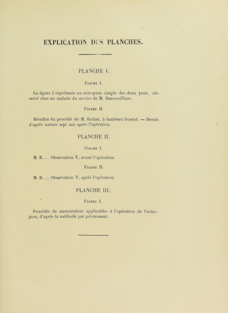 EXPLICATION DE S PLANCHES PLANCHE I. Figure J. La ligure I représente un ectropion simple des deux yeux , ob- servé chez un malade du service de M. Denonvilliers. Figure II. Késultat du procédé de M. Kicliet, à lambeau frontal. — Dessin d’après nature sept ans après l’opération. PLANCHE II. Figure I. M. B Observation V, avant l’opération. Figure 11. M. B Observation Y, après l’opération. PLANCHE III. Figure I. Procédés de mensuration applicables à l’opération de l’ectro pion, d'après la méthode par pviotement.