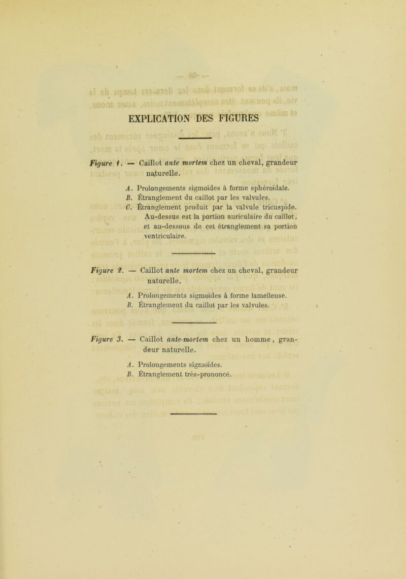 EXPLICATION DES FIGURES Figure 1. — Caillot ante mortem chez un cheval, grandeur naturelle. A. Prolongements sigmoïdes à forme sphéroïdale. B. Étranglement du caillot par les valvules. C. Étranglement produit par la valvule tricuspide. Au-dessus est la portion auriculaire du caillot, et au-dessous de cet étranglement sa portion ventriculaire. Figure 2. — Caillot ante mortem chez un cheval, grandeur naturelle. A. Prolongements sigmoïdes à forme lamelleuse. B. Étranglement du caillot par les valvules. Figure 3. — Caillot ante-morlem chez un homme, gran- deur naturelle. A. Prolongements sigmoïdes. B. Étranglement très-prononcé.
