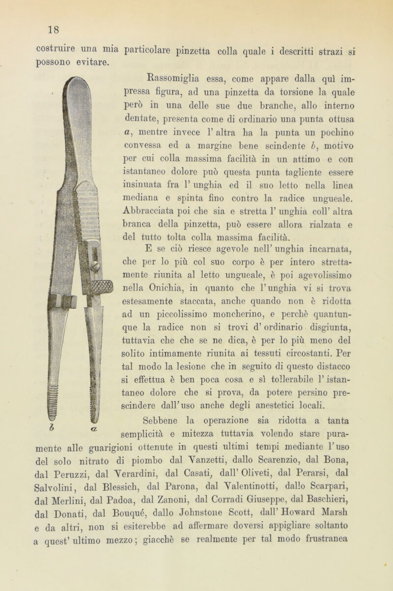 s l'il costruire una mia particolare pinzetta colla quale i descritti strazi si possono evitare. Rassomiglia essa, come appare dalla qui im- pressa figura, ad una pinzetta da torsione la quale però in una delle sue due branche, allo interno dentate, presenta come di ordinario una punta ottusa a, mentre invece 1’ altra ha la punta un pochino convessa ed a margine bene scindente à, motivo per cui colla massima facilità in un attimo e con istantaneo dolore può questa punta tagliente essere insinuata fra F unghia ed il suo letto nella linea mediana e spinta fino contro la radice ungueale. Abbracciata poi che sia e stretta F unghia coll’ altra branca della pinzetta, può essere allora rialzata e del tutto tolta colla massima facilità. E se ciò riesce agevole nelF unghia incarnata, che per lo più col suo corpo è per intero stretta- mente riunita al letto ungueale, è poi agevolissimo nella Onichia, in quanto che l’unghia vi si trova estesamente staccata, anche quando non è ridotta ad un piccolissimo moncherino, e perchè quantun- que la radice non si trovi d’ordinario disgiunta, tuttavia che che se ne dica, è per lo più meno del solito intimamente riunita ai tessuti circostanti. Per tal modo la lesione che in seguito di questo distacco si effettua è ben poca cosa e sì tollerabile F istan- taneo dolore che si prova, da potere persino pre- scindere dall’uso anche degli anestetici locali. Sebbene la operazione sia ridotta a tanta semplicità e mitezza tuttavia volendo stare pura- mente alle guarigioni ottenute in questi ultimi tempi mediante Fuso del solo nitrato di piombo dal Yanzetti, dallo Scarenzio, dal Bona, dal Peruzzi, dal Yerardini, dal Casati, dall’ Oliveti, dal Perarsi, dal Salvolini, dal Blessich, dal Parona, dal Yalentinotti, dallo Scarpari, dal Merlini, dal Padoa, dal Zanoni, dal Corradi Giuseppe, dal Baschieri, dal Donati, dal Bouqué, dallo Johnstone Scott, dall’ Howard Marsh e da altri, non si esiterebbe ad affermare doversi appigliare soltanto a quest’ ultimo mezzo ; giacché se realmente per tal modo frustranea #