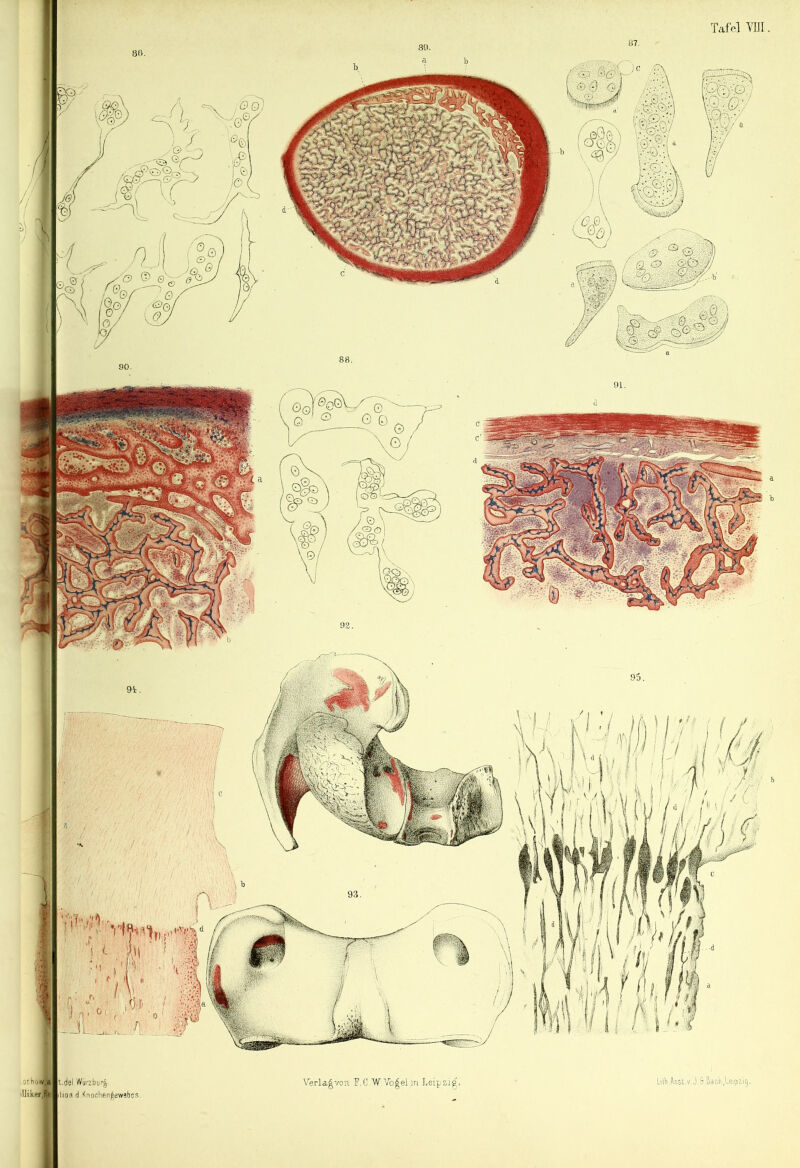 mm2 cl 80. 89. 87. Tafel m . Verla^voTL T.C W Yo^eljn Leipzig. Lilk.Anst.v.J.5 Badtfeipiij, .ochü«,a illtkfj'.fe t.del Wurzbur^ lion d Knochen^ewsbes,