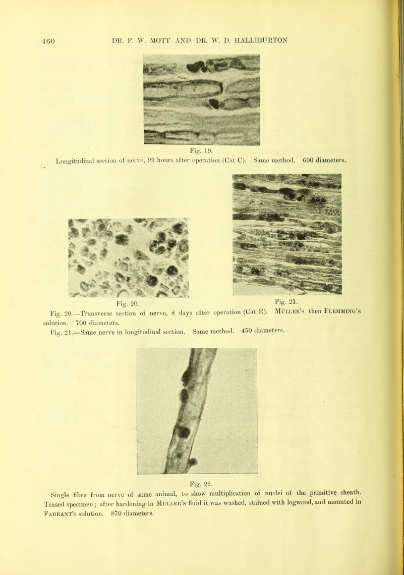 Longitudinal section of nerve, 99 hours after operation (Cat C). Same method. GOO diameters. Fig. 20.—Transverse section of nerve, 8 days after operation (Cat R). Muller s then Flemming s solution. 700 diameters. Fig. 21.—Same nerve in longitudinal section. Same method. 450 diameters. Single fibre fiom nerve of same animal, to show multiplication of nuclei of the primitive sheath. Teased specimen; after hardening in Muller’s fluid it was washed, stained with logwood, and mounted in Farrant’s solution. 870 diameters.