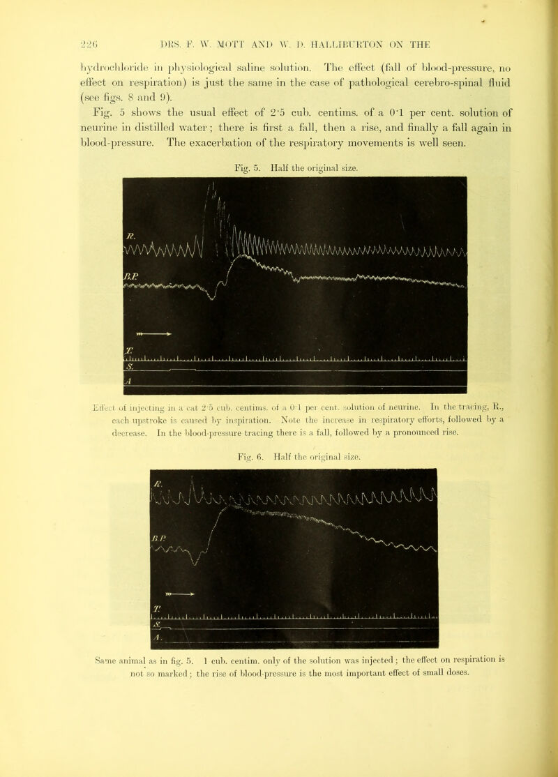 Itydi'ocliloiide in plij'siological saline solution. The effect (fall of blood-pressure, no effect on respiration) is just the same in the case of pathological cerebro-spinal fluid (see figs. 8 and 9). Fig. 5 shows the usual effect of 2’5 cuh. centims. of a Off per cent, solution of neurine in distilled water; there is first a fall, then a rise, and finally a fall again in blood-pressure. The exacerbation of the respiratory movements is well seen. Fig. 5. Half the original size. Erfect of injecting in a cat 2’5 cub. centims. of a OT per cent, solution of. neurine. In the tracing, R., each upstroke is caused b_y inspiration. Note the increase in re.spiratory efforts, followed by a decrease. In the Idood-prossitre tracing there is a fall, followed by a pronounced rise. Fig. fi. Half the original size. dir- A. Same animal as in fig. 5. 1 cub. centim. only of the solution was injected; the effect on respiration is not so marked; the rise of blood-pressure is the most important effect of small doses.